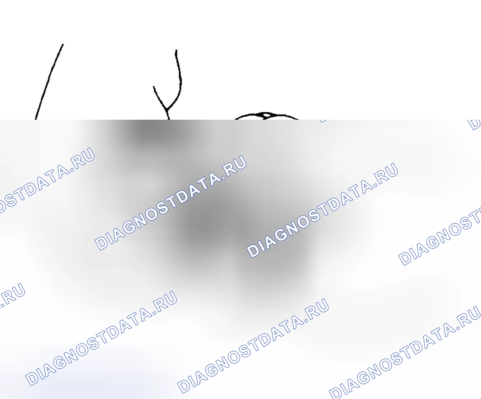 Рис. 37: Проверка шестерни на износ и повреждение. Subaru Outback BH