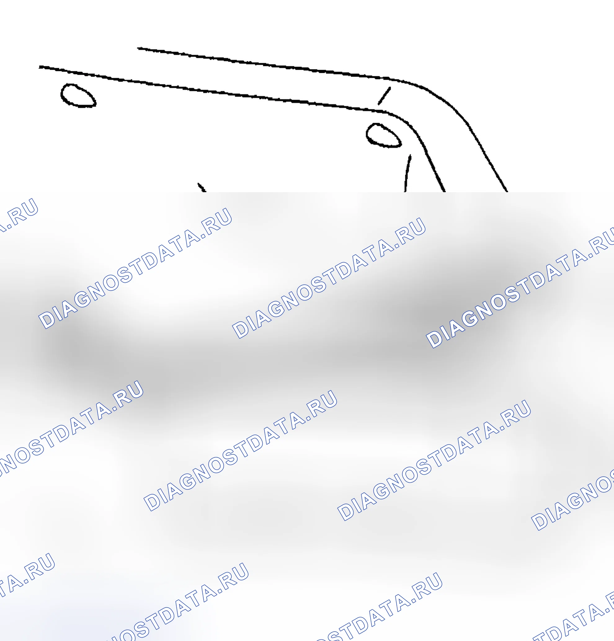 Рис. 267: Порядок демонтажа. Hyundai Venue I