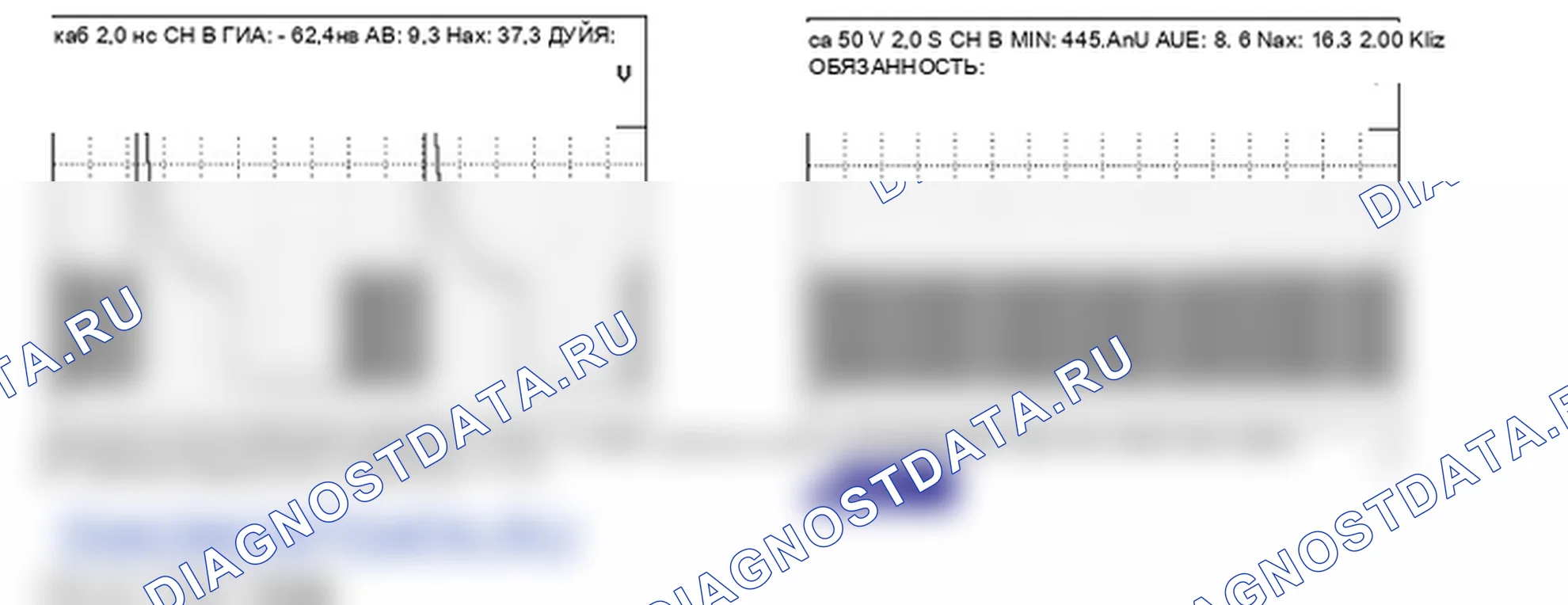 Анализ формы сигнала и данных — P0760. Hyundai Santa Fe CM