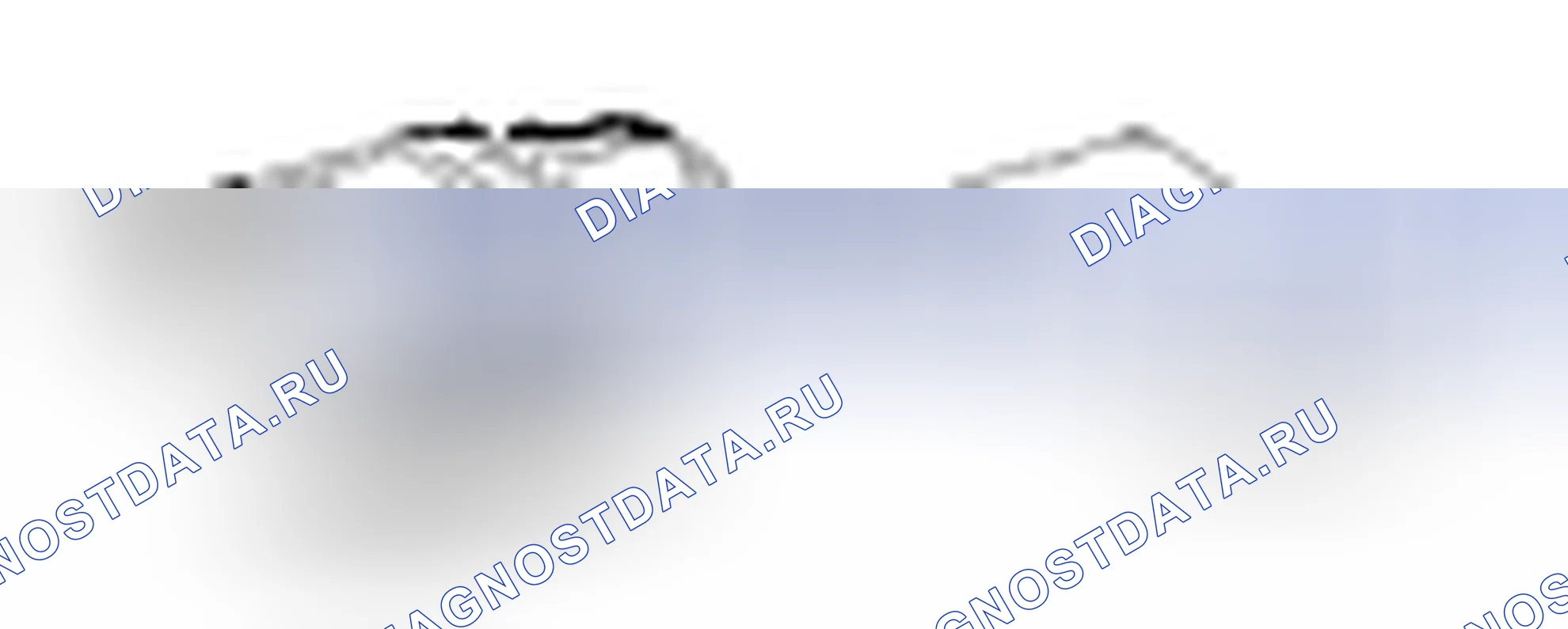 Рис. 157: РЕКОМЕНДУЕМЫЕ ИНСТРУМЕНТЫ. Kia Sorento I рестайлинг