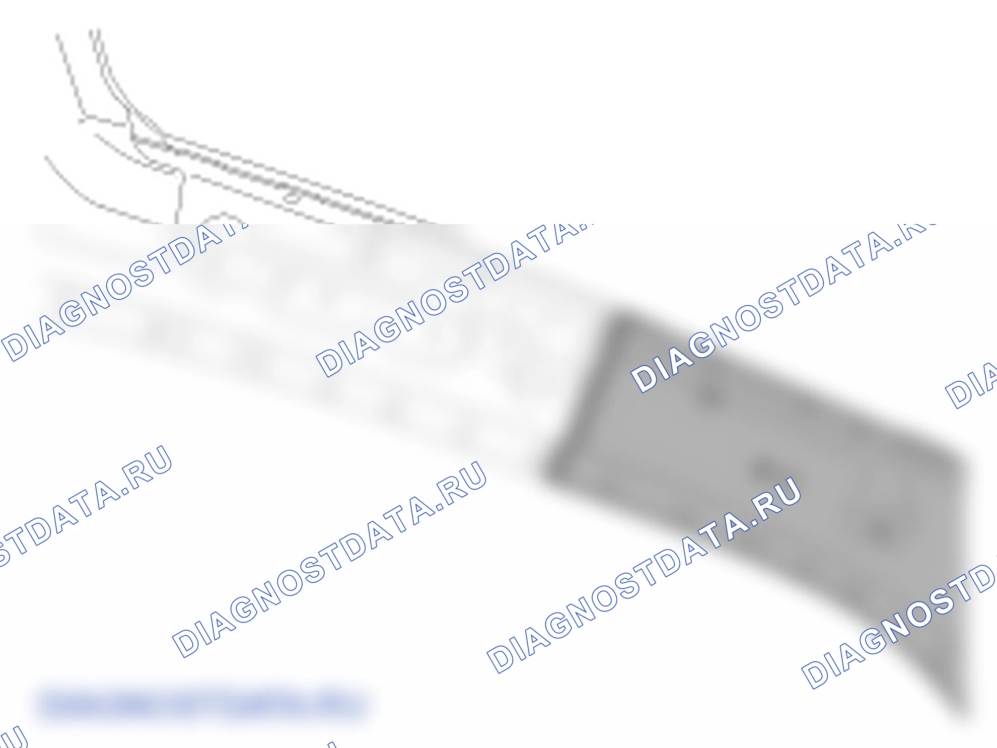 Установка передней стойки. Hyundai ix35 EL