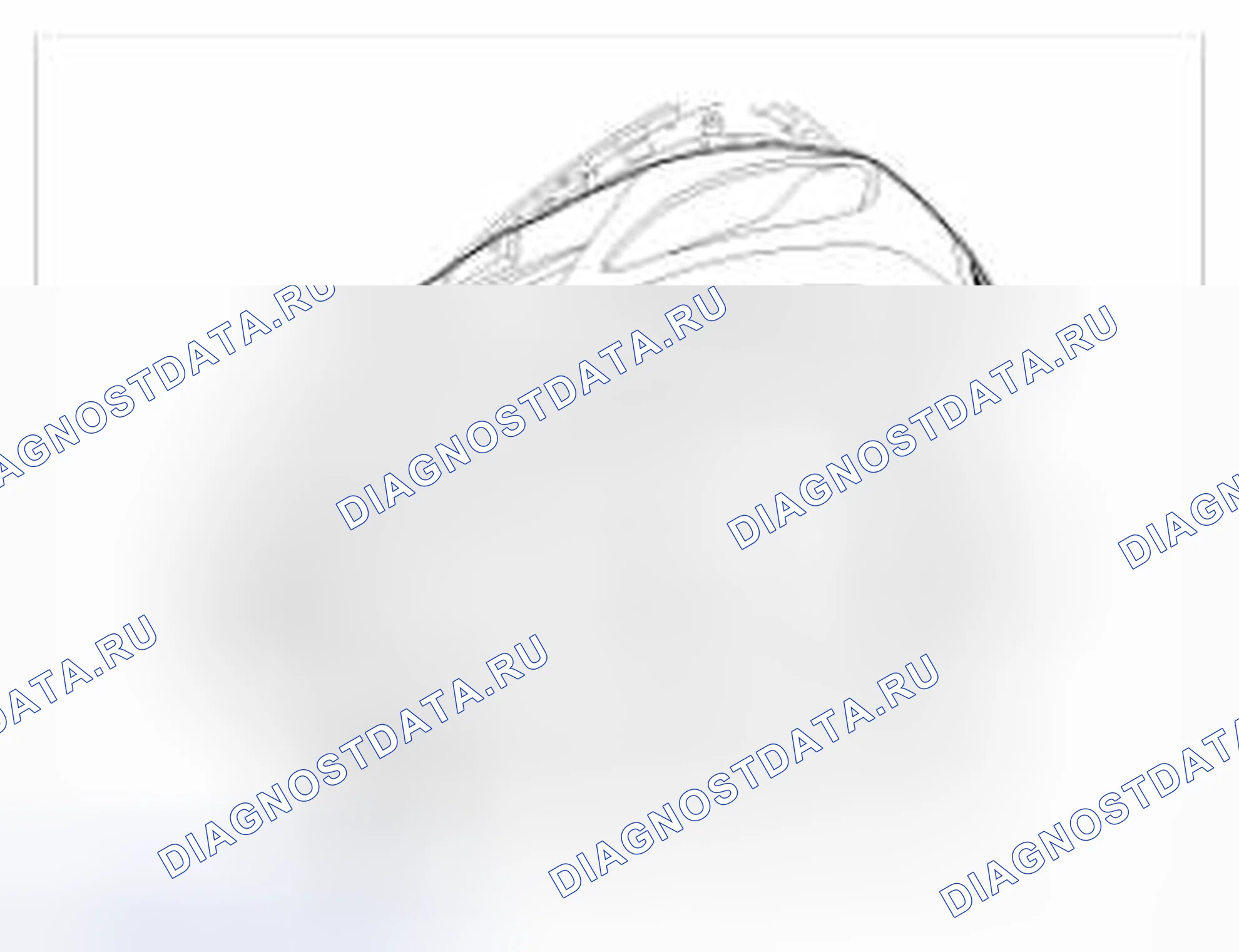 Рис. 3. Hyundai Accent IV