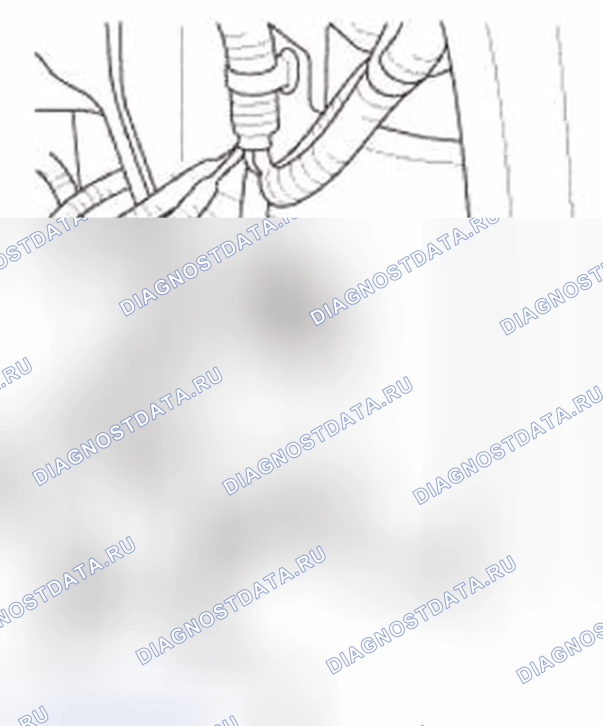 Рис. 14. Honda Civic IX