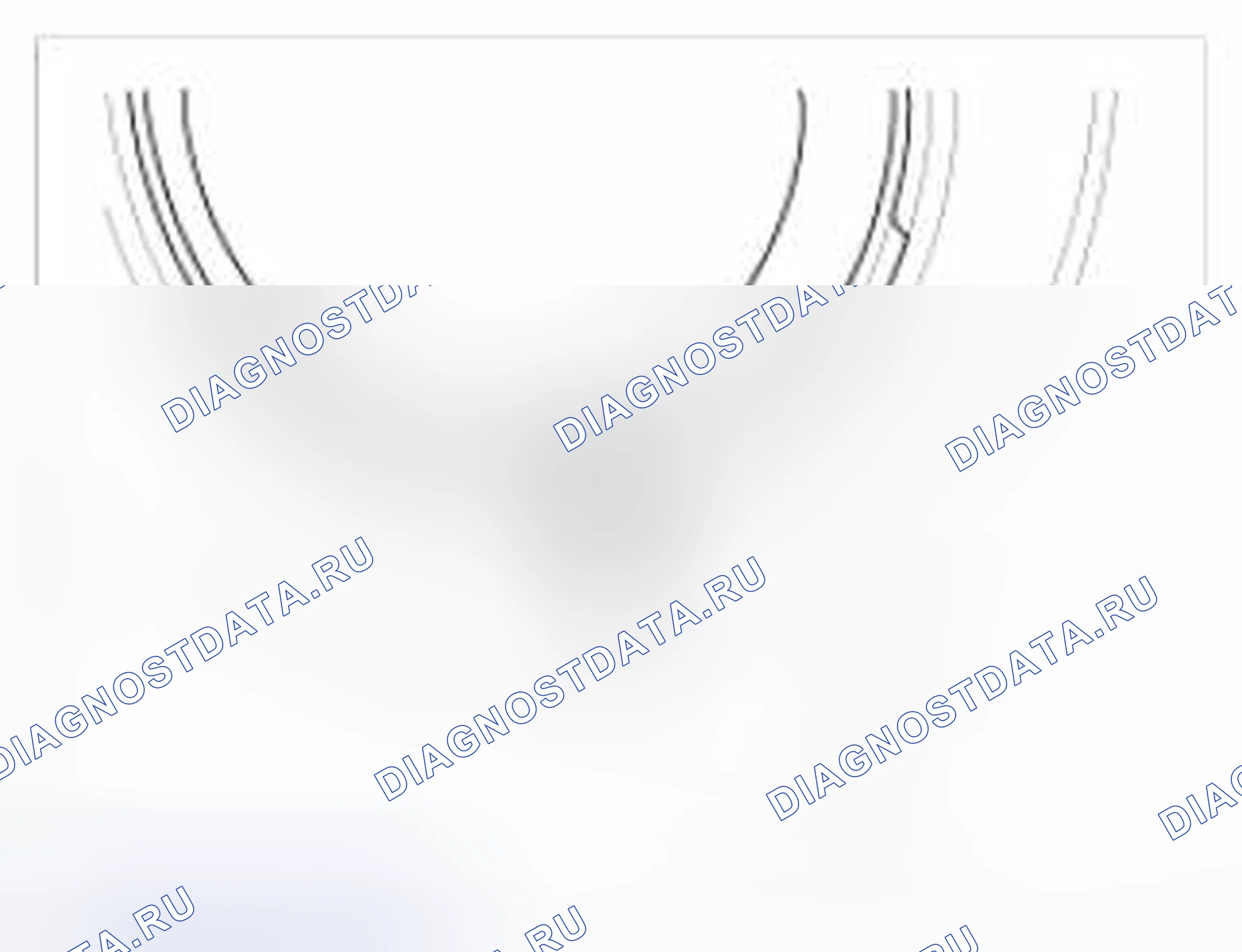 Рис. 14: Установка. BMW 6 серия F06/F13/F12