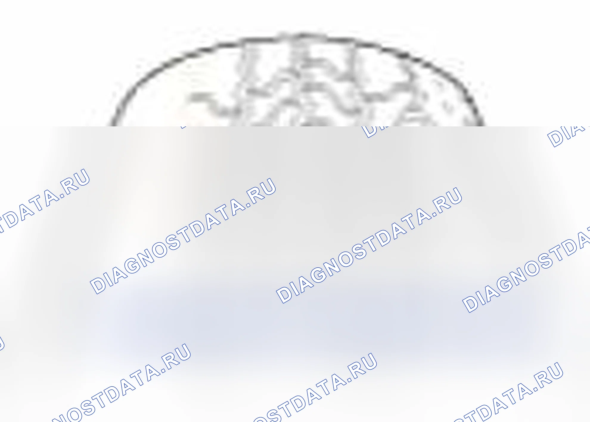 Рис. 9. Kia Forte I
