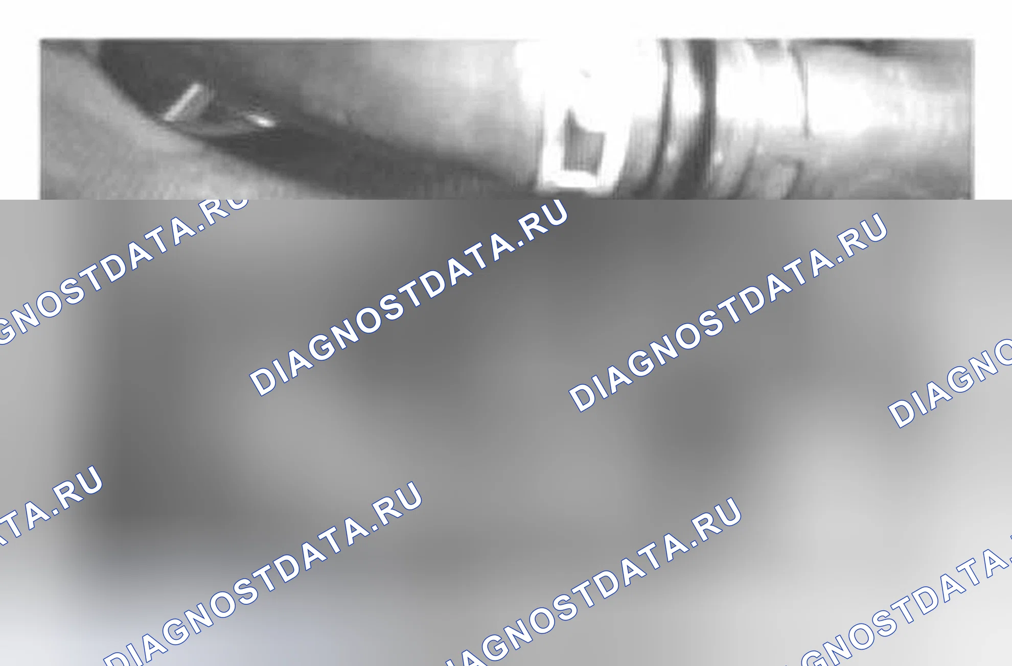 Рис. 251: Удаление. Ford Fiesta Mk6