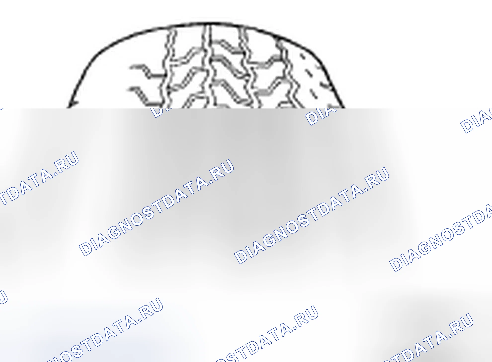 Рис. 3. Hyundai Azera I