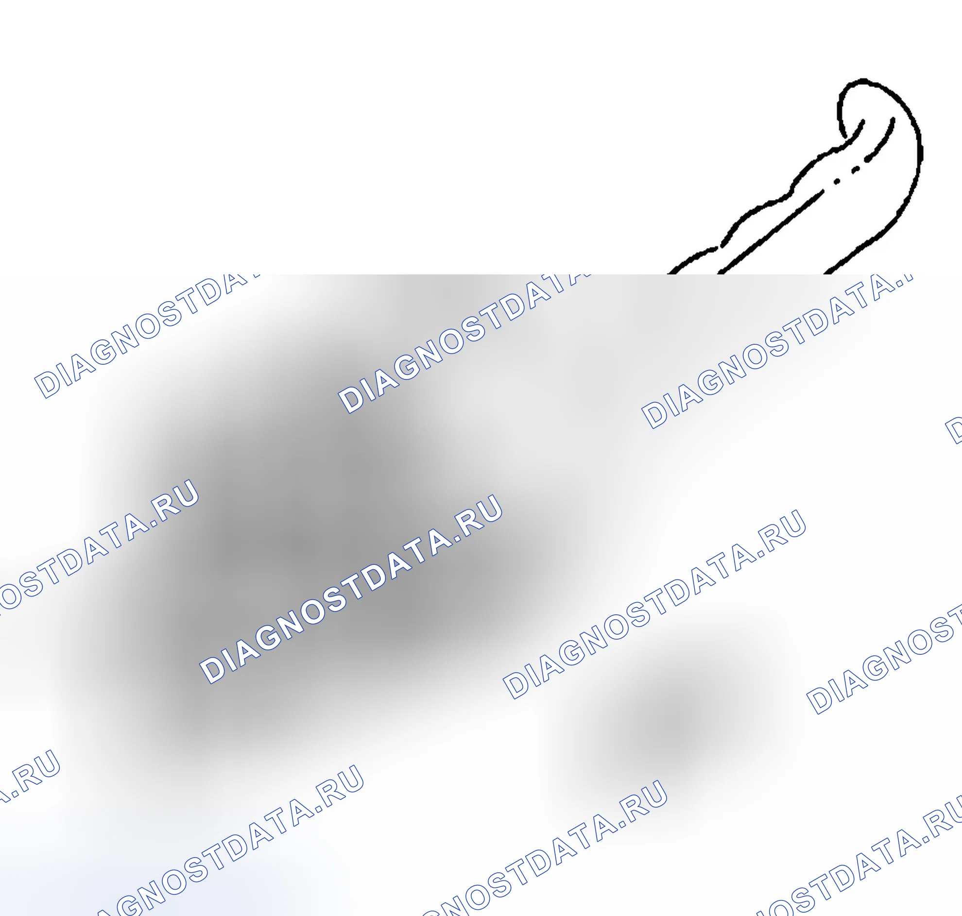 Рис. 240: Процедура удаления. Chevrolet Silverado 1500 HD 