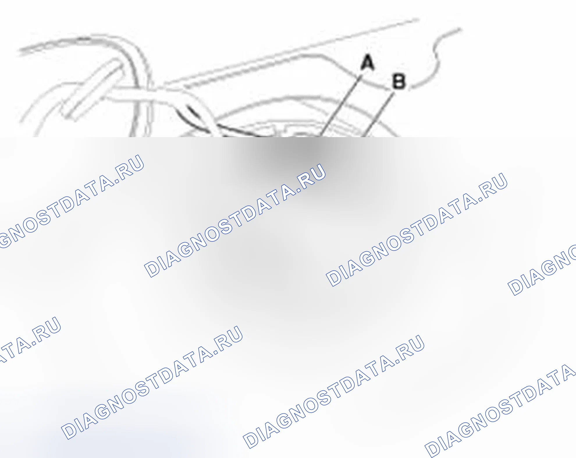 Рис. 64. Hyundai Elantra V