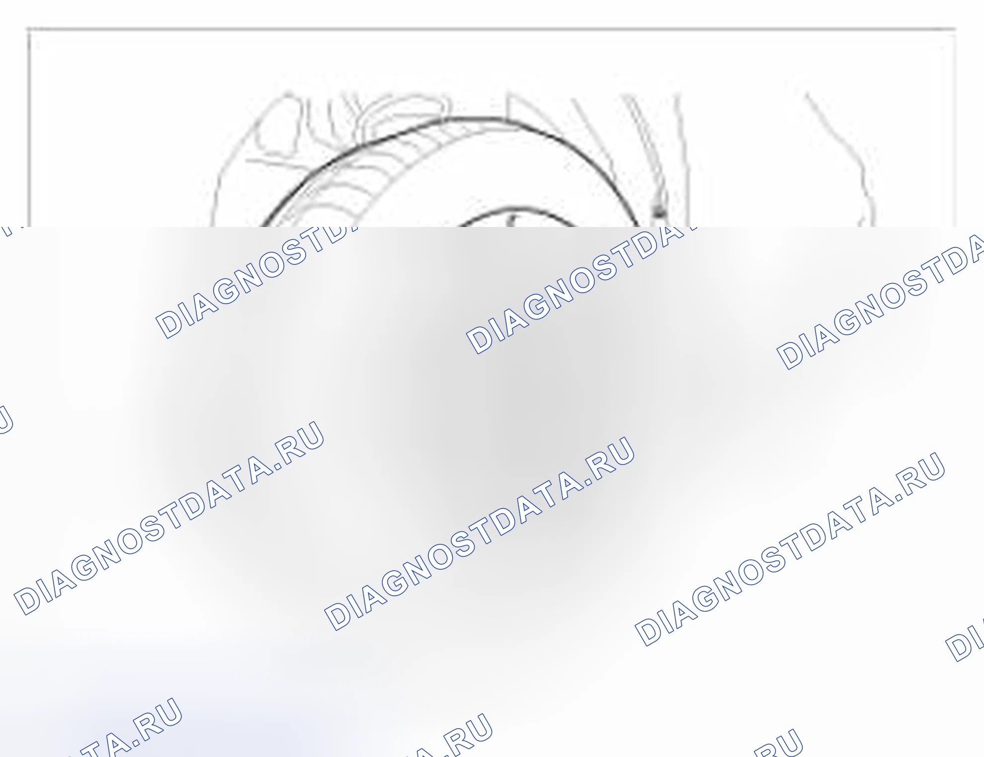 Рис. 20: Замена. BMW 6 серия F06/F13/F12