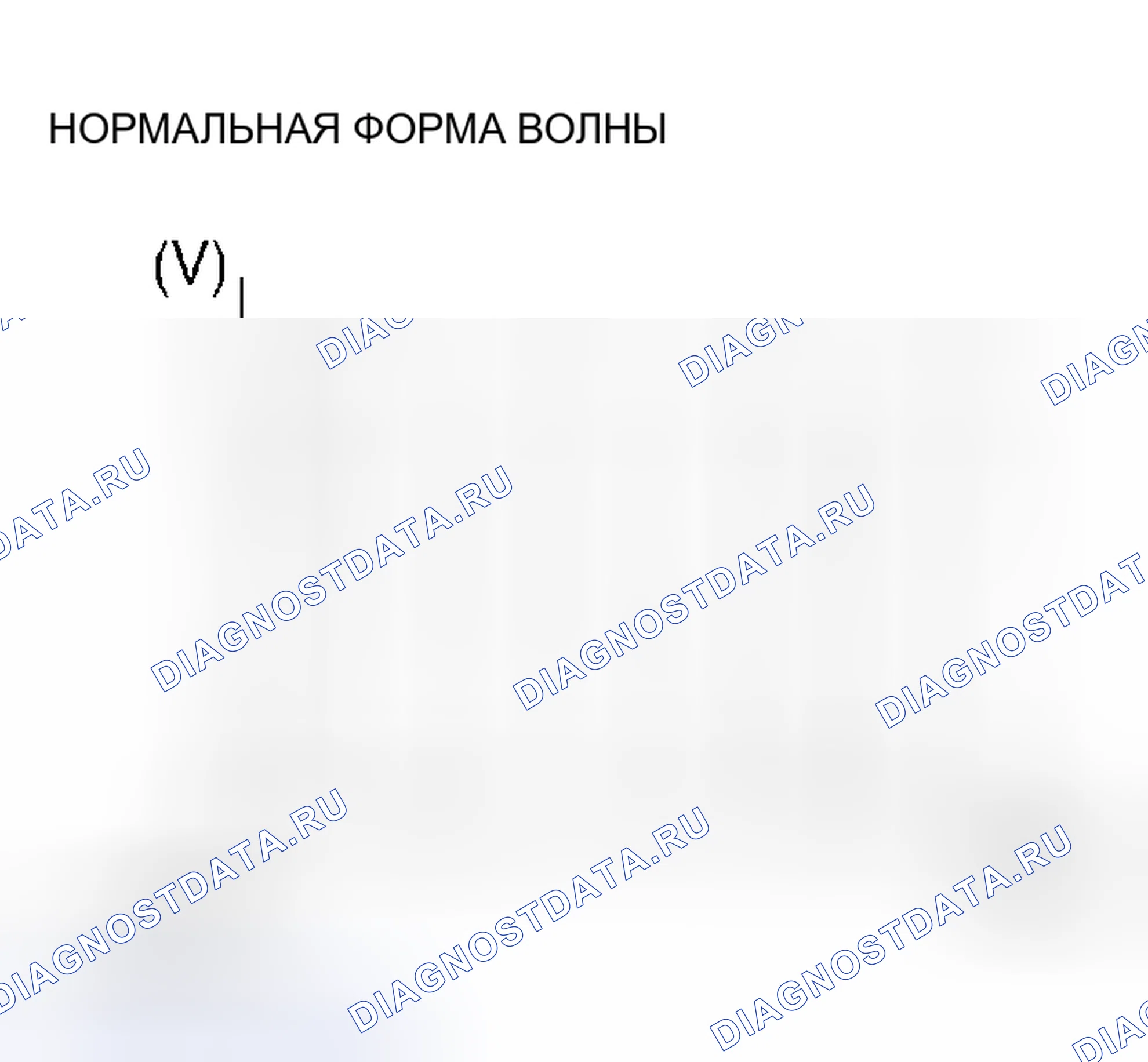 Рис. 189. Mitsubishi Lancer IX рестайлинг