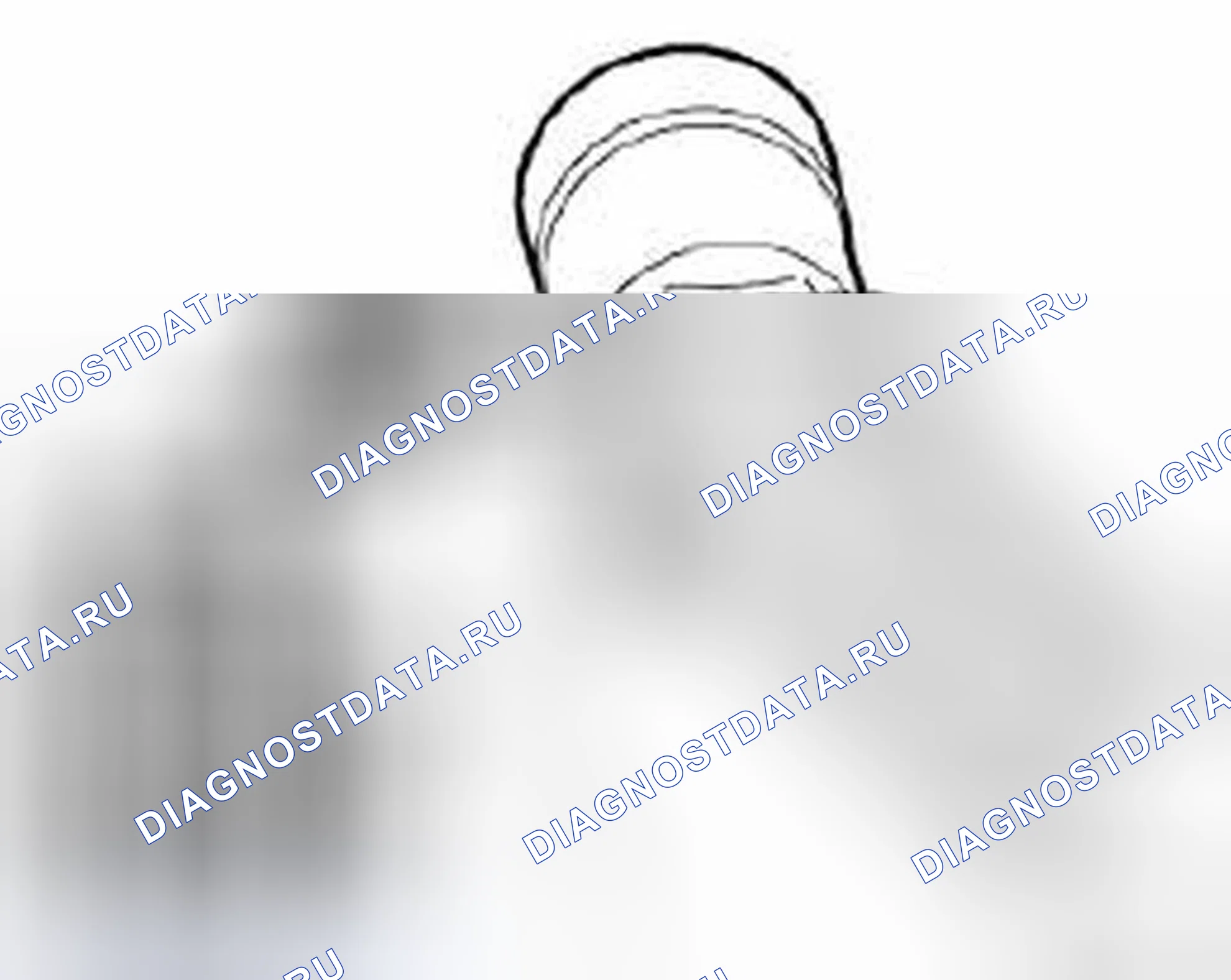 Рис. 172: Установка. BMW Z3 E36