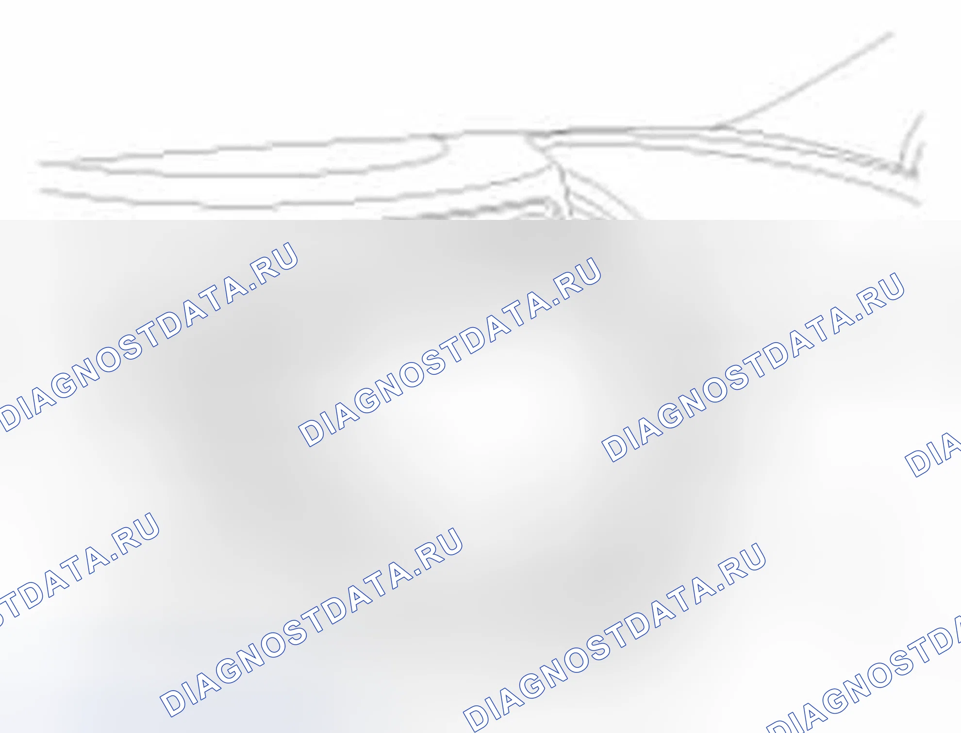 Рис. 57. Hyundai Elantra V