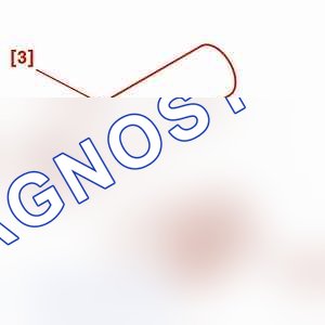 Демонтаж: двигателя — b1bk0j1c. Peugeot 106 I