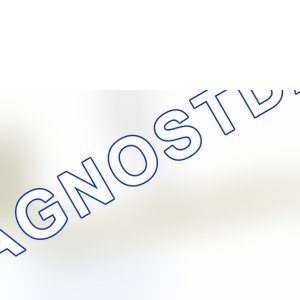 Снятие - Установка: ремень ГРМ — e5ap1yyc. Peugeot 207 Compact I