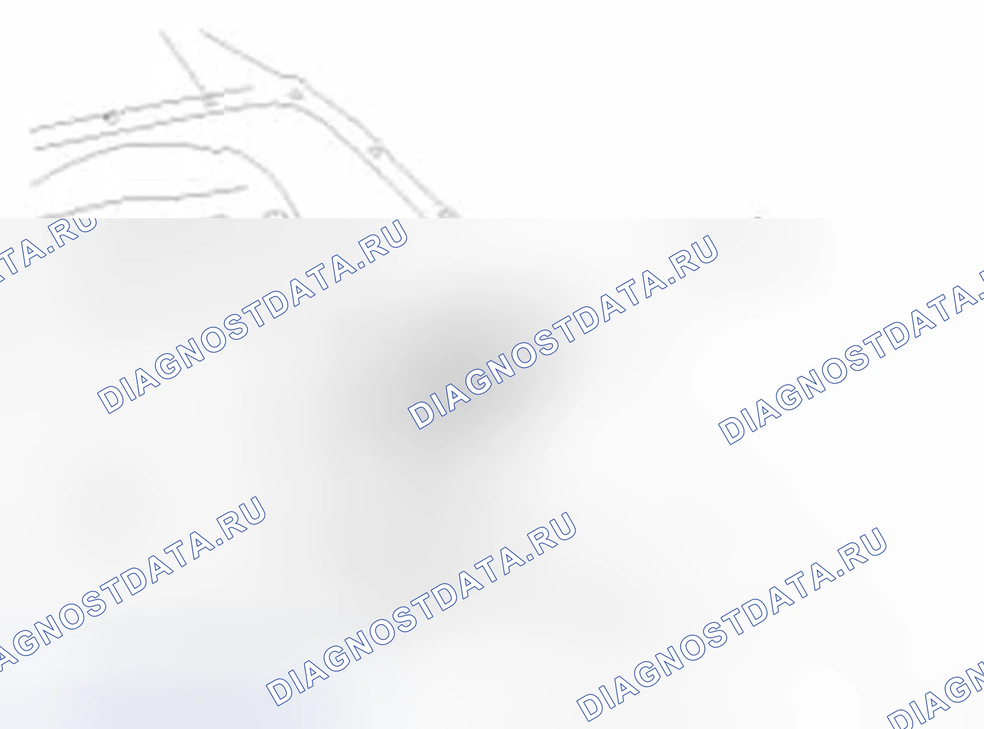Рис. 38: Повторная сборка. Hyundai Equus II