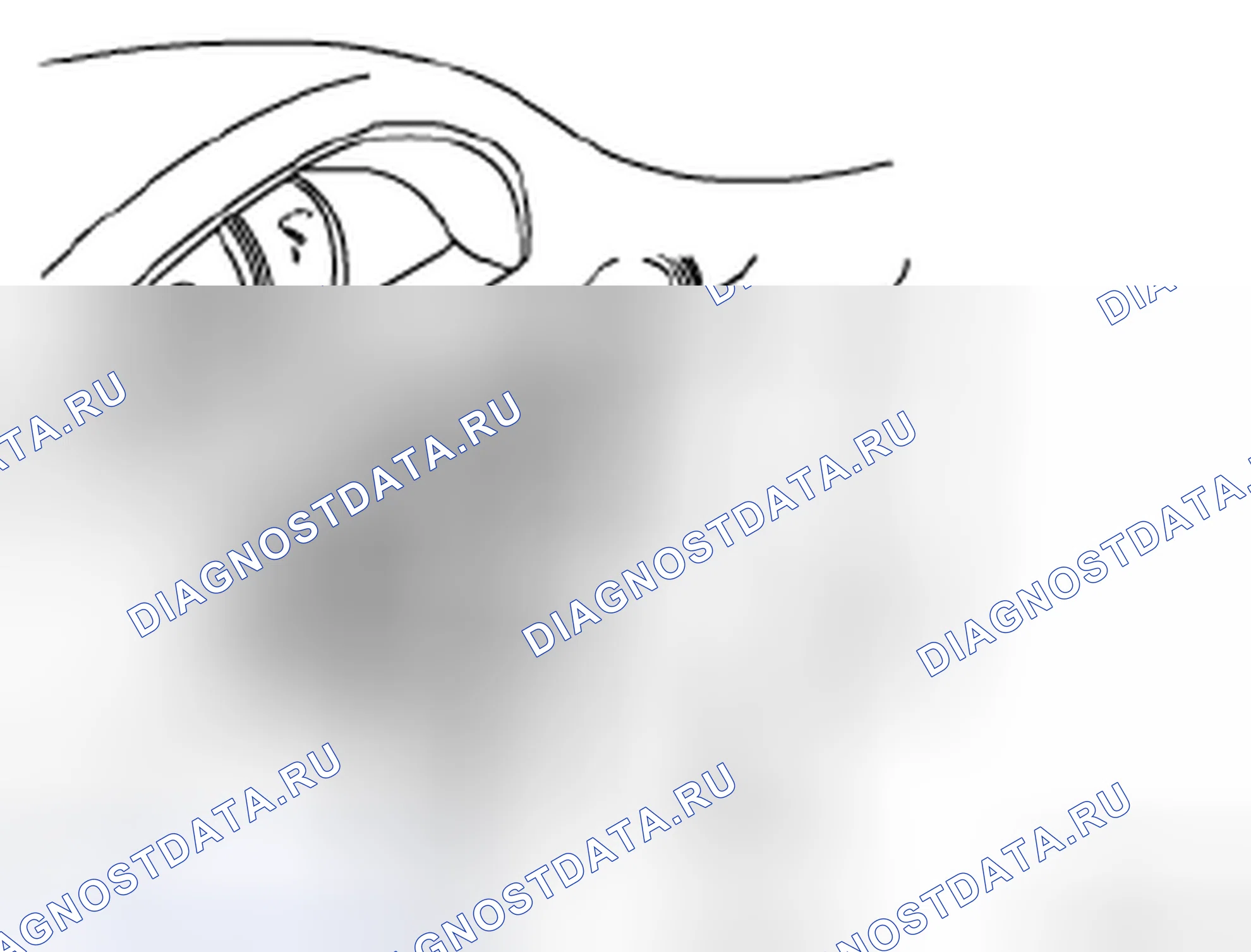 Рис. 19: Установка. Suzuki Forenza I