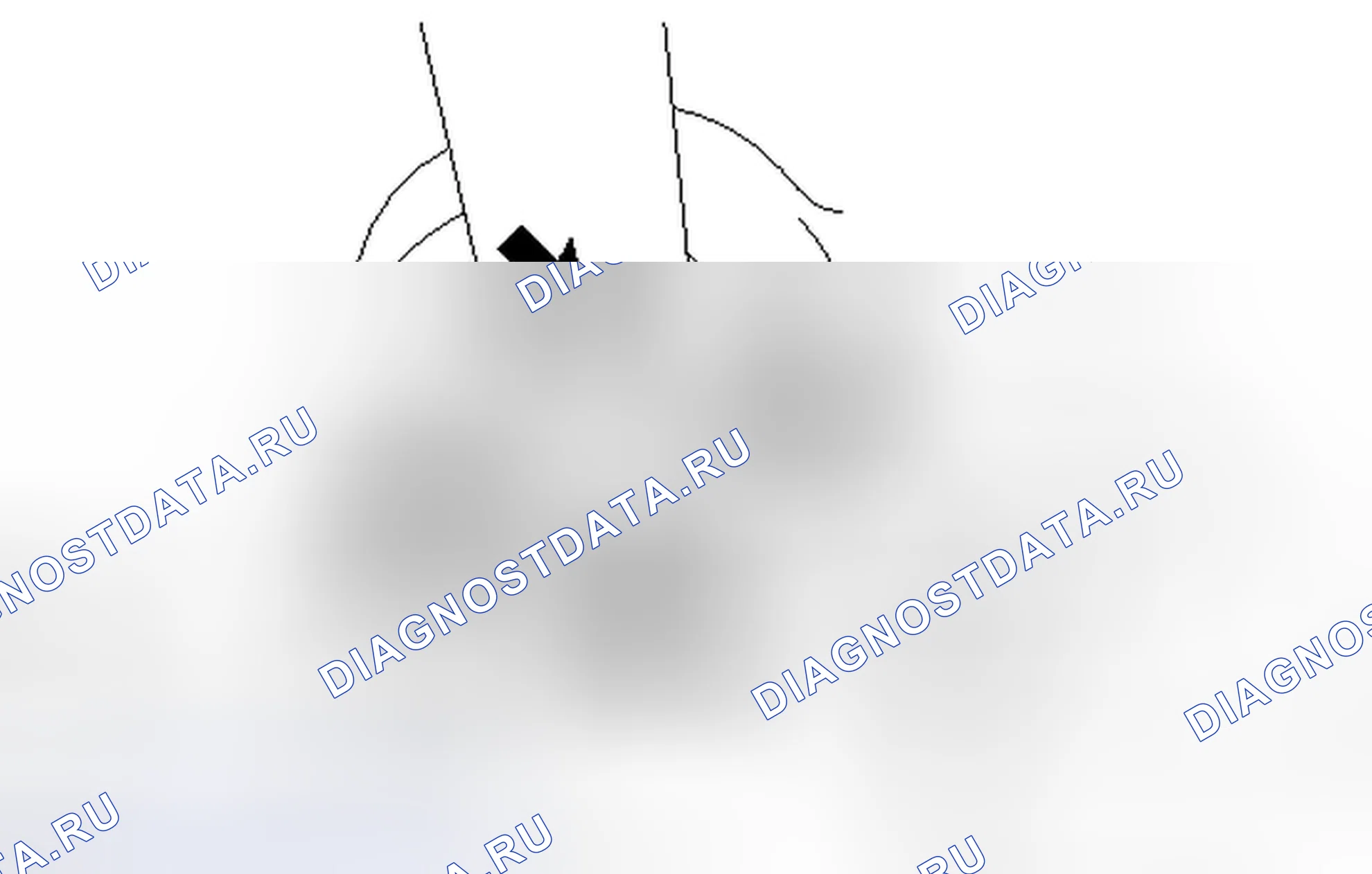 Рис. 6: УДАЛЕНИЕ [07 / 2013 -]. Kia Sorento IV