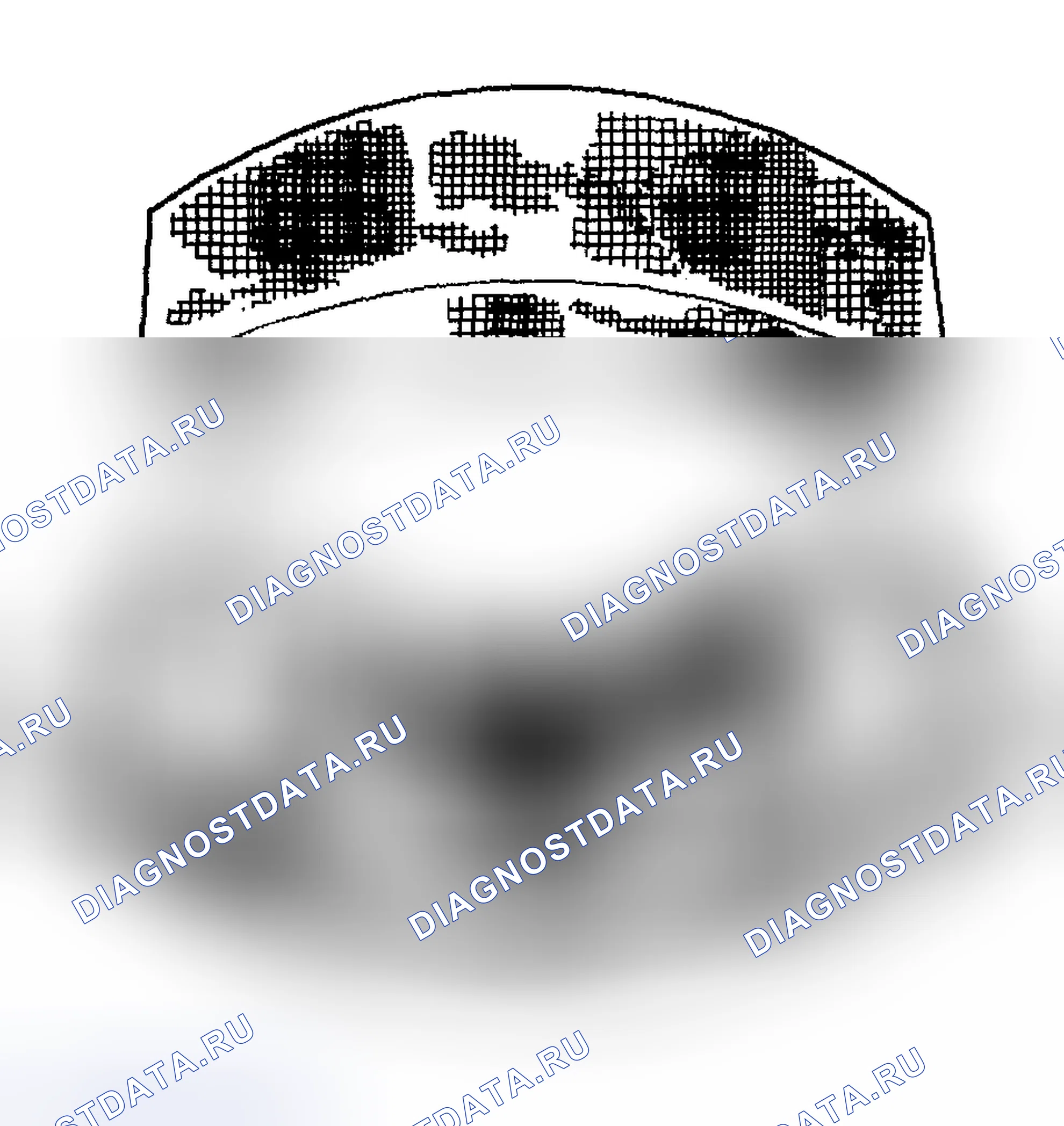 Рис. 90: Фреттаж. Hyundai Tiburon II рестайлинг