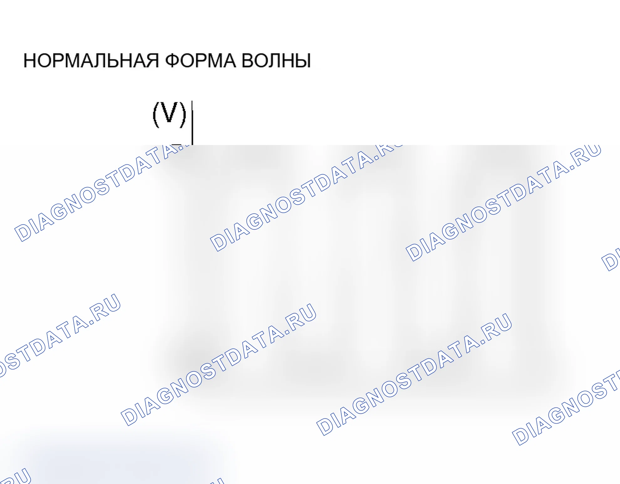 Рис. 58. Mitsubishi Lancer Evolution IX