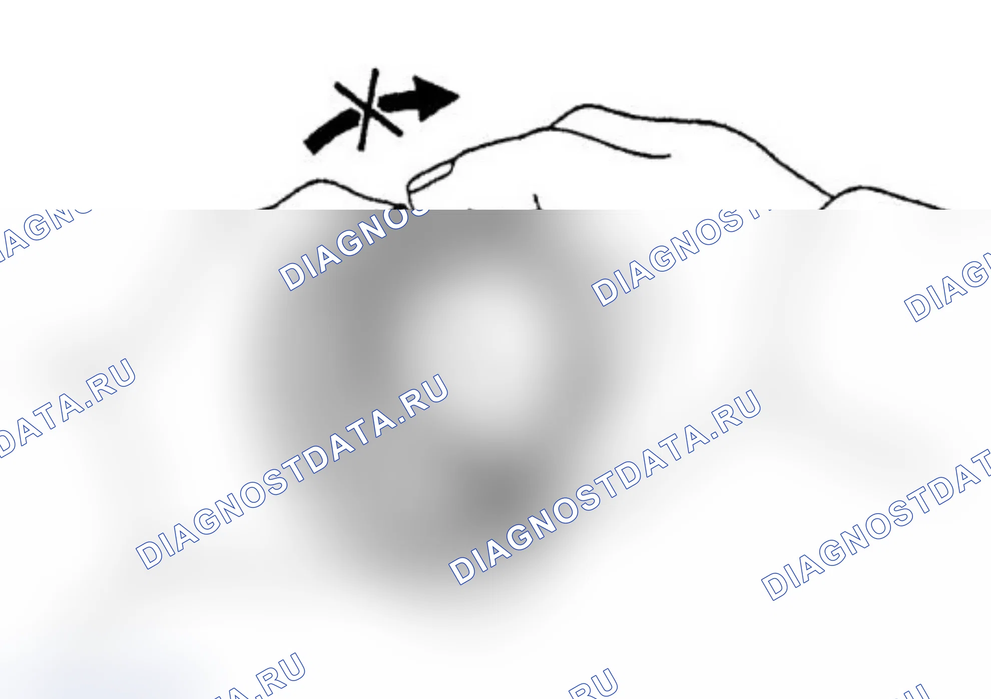 Разборка / установка — Great Wall King-Kong-Cannon. Great-Wall King Kong Cannon I