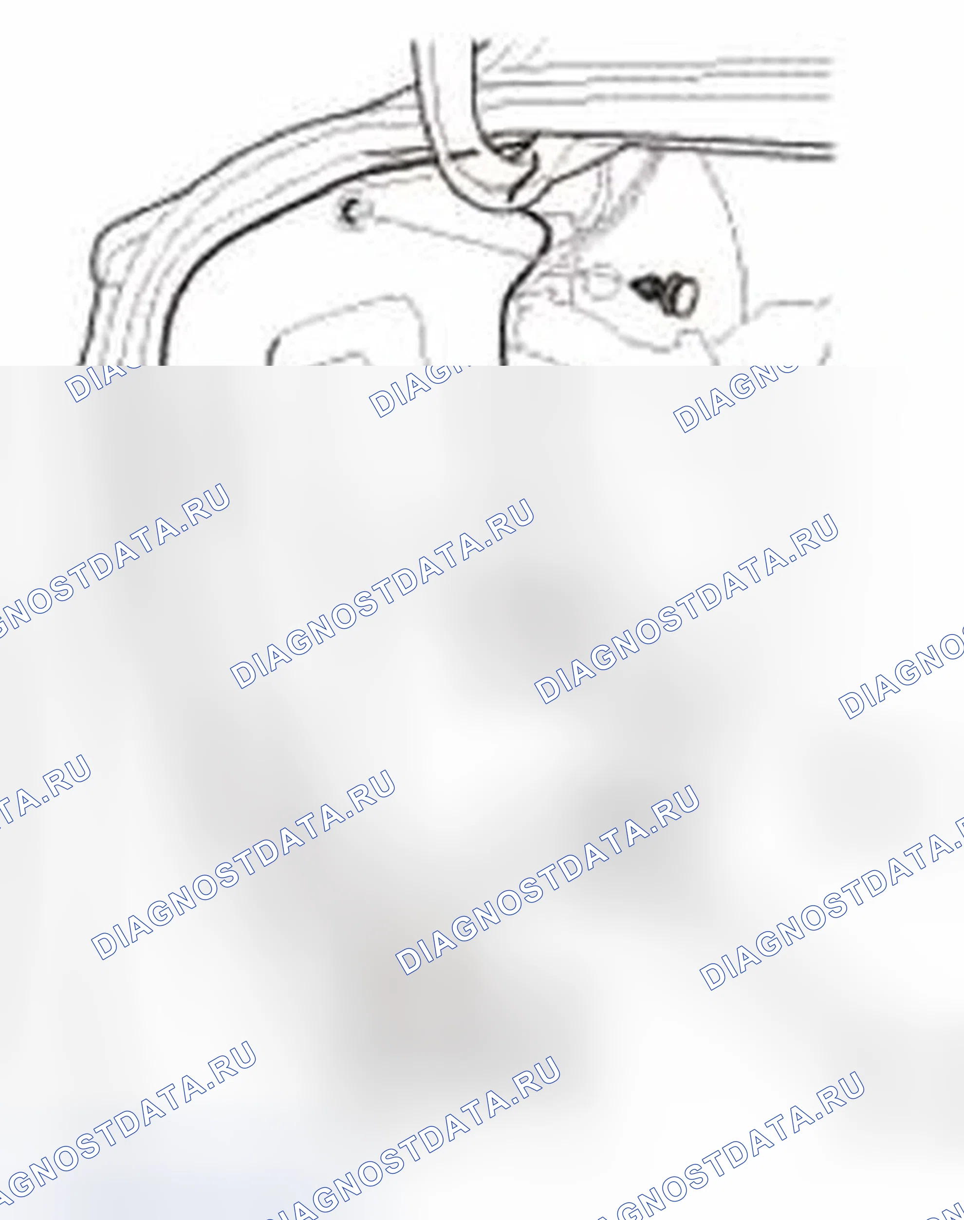 Рис. 894. Honda Civic IX