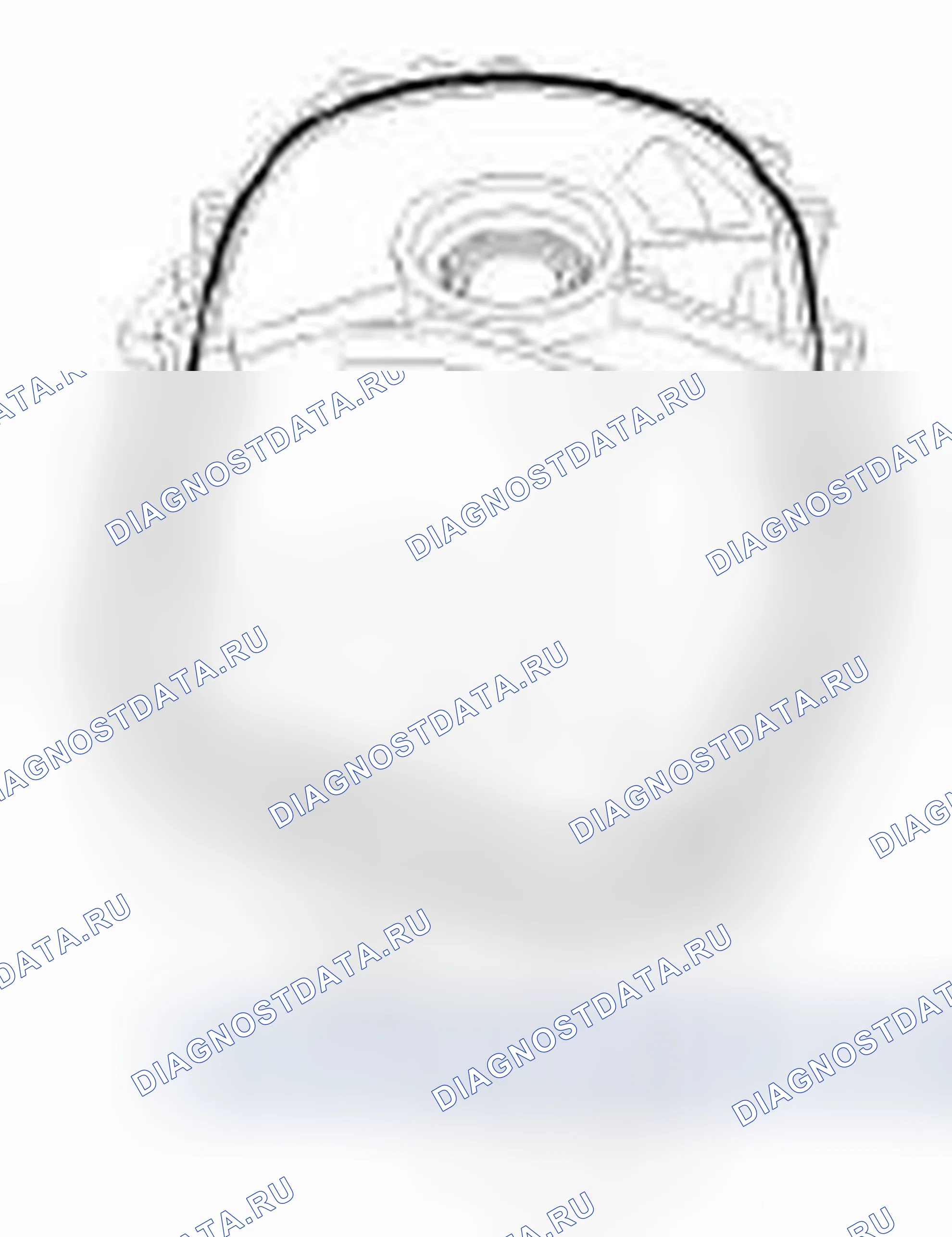 Рис. 83. Hyundai Elantra IV