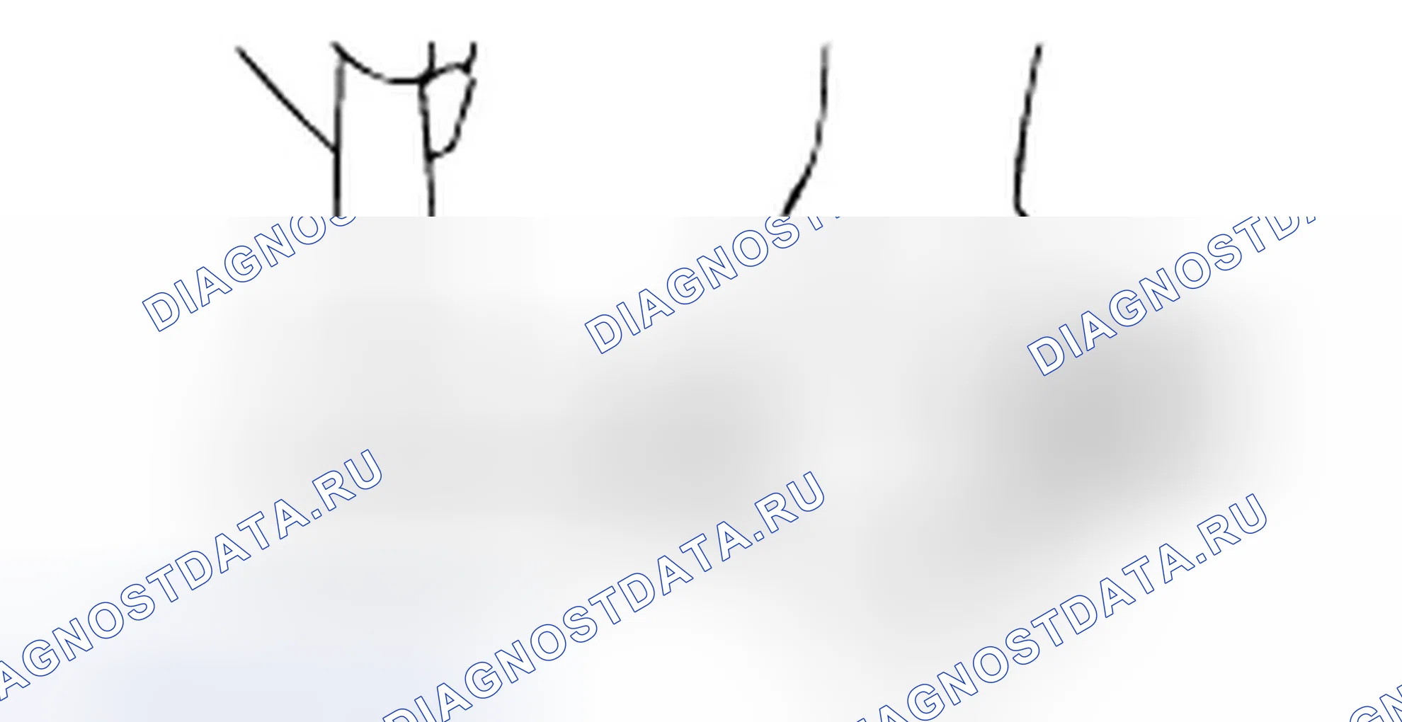 Проверка рулевого редуктора. Hyundai H-1 A1
