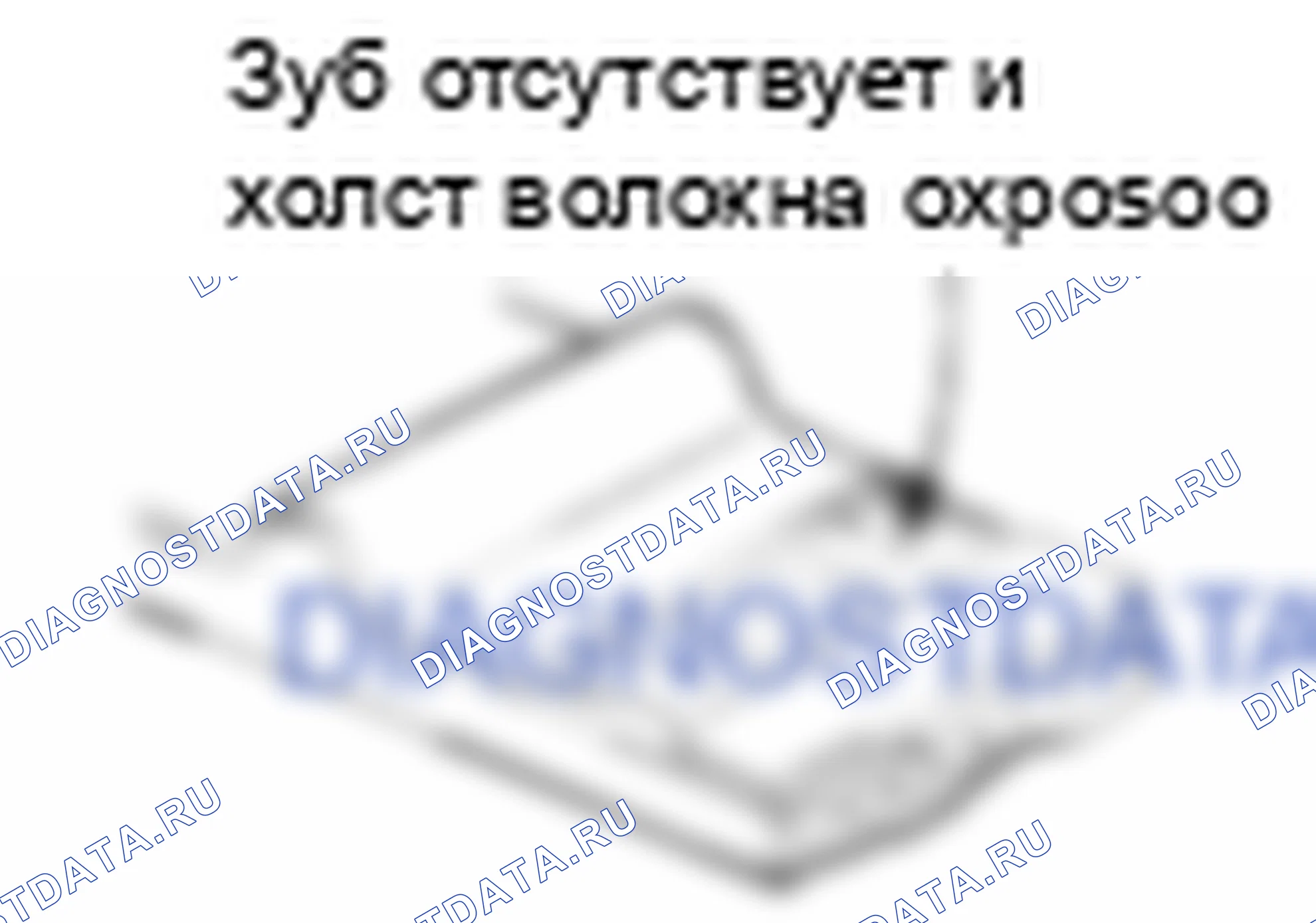 Проверка ремня ГРМ. Hyundai Atos MX