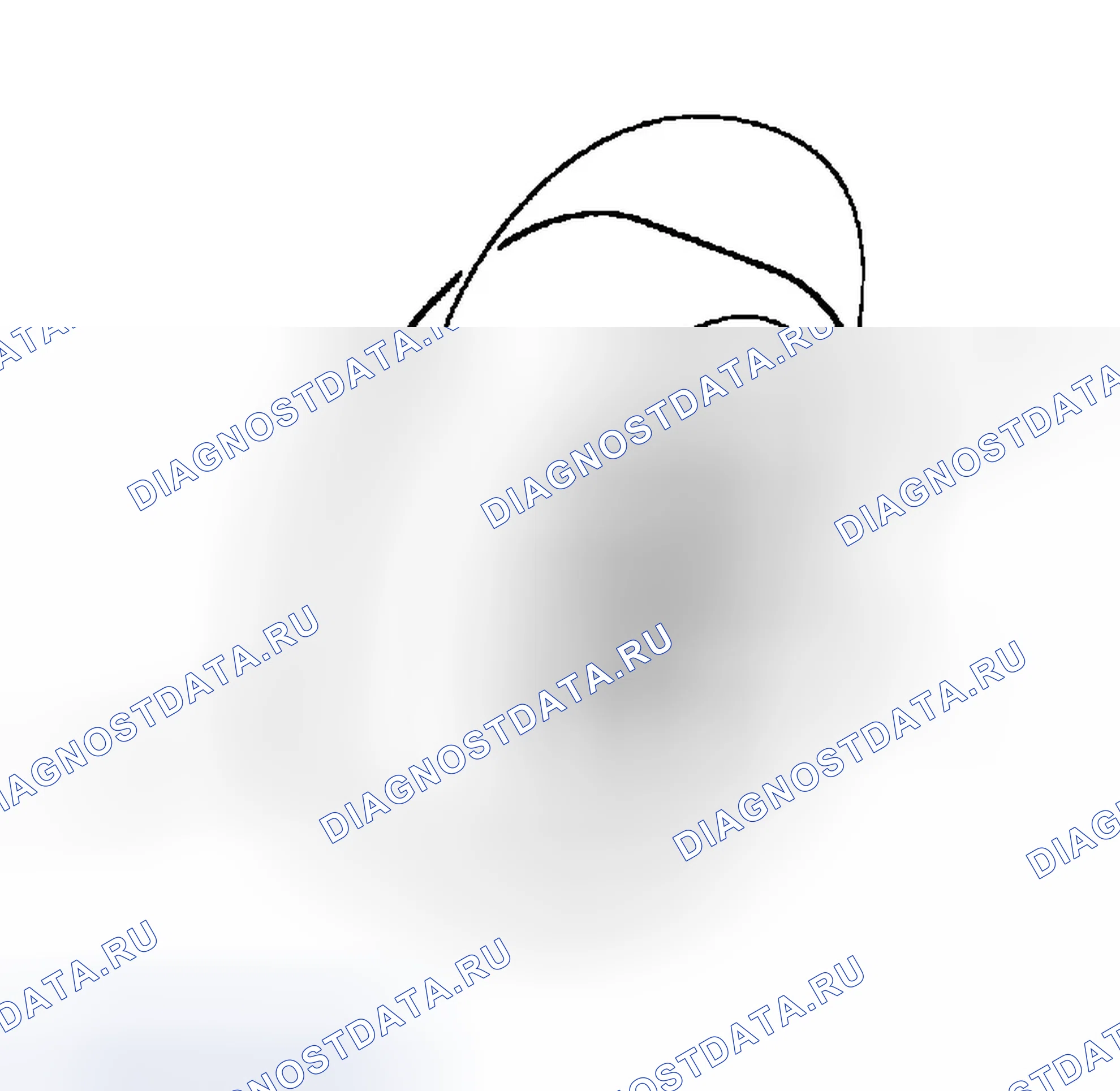 Рис. 4. Hyundai Accent II