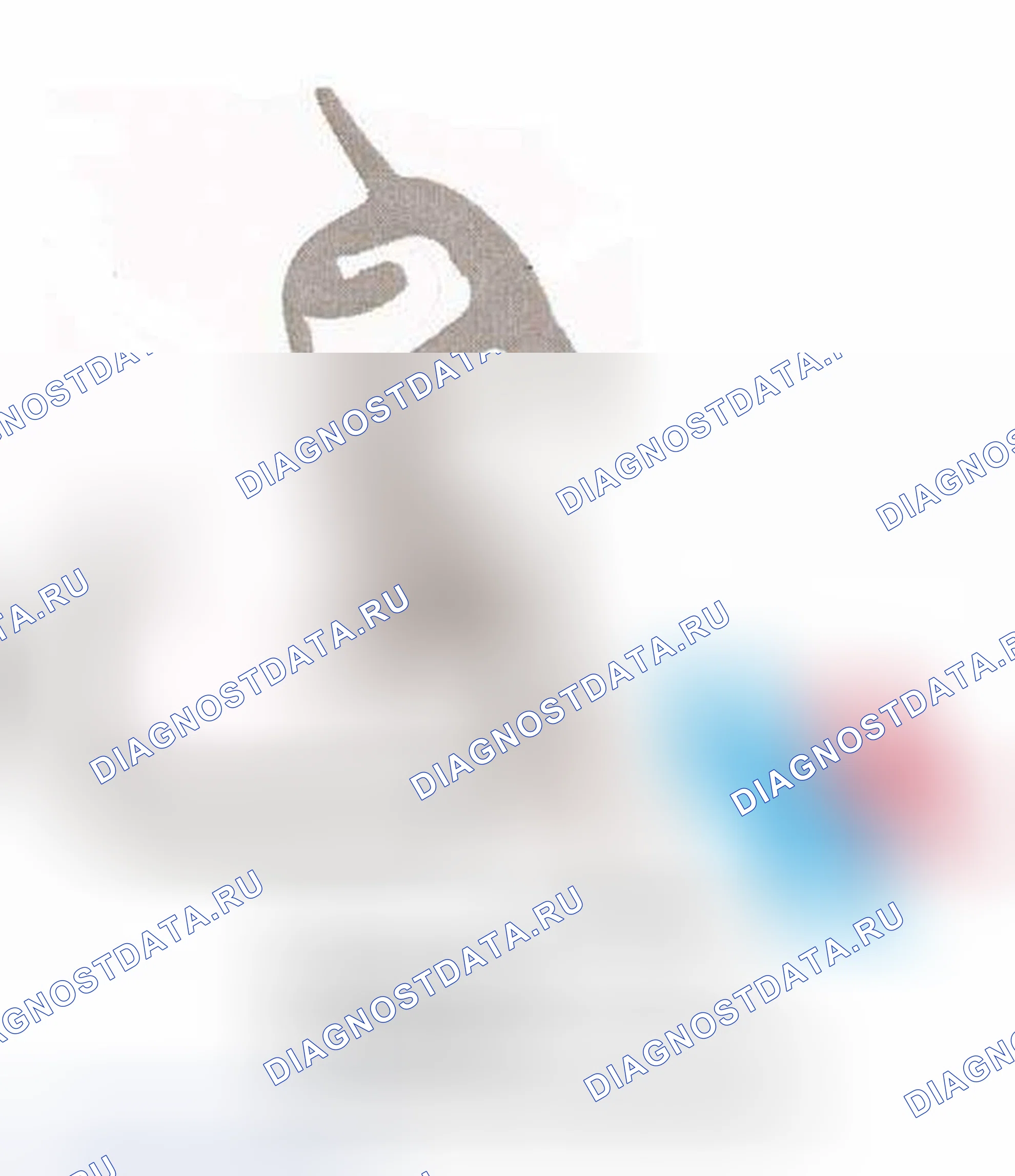 Рис. 93: Окно Anti-Trap Detection (Обнаружение ловушек). BMW X5 E53