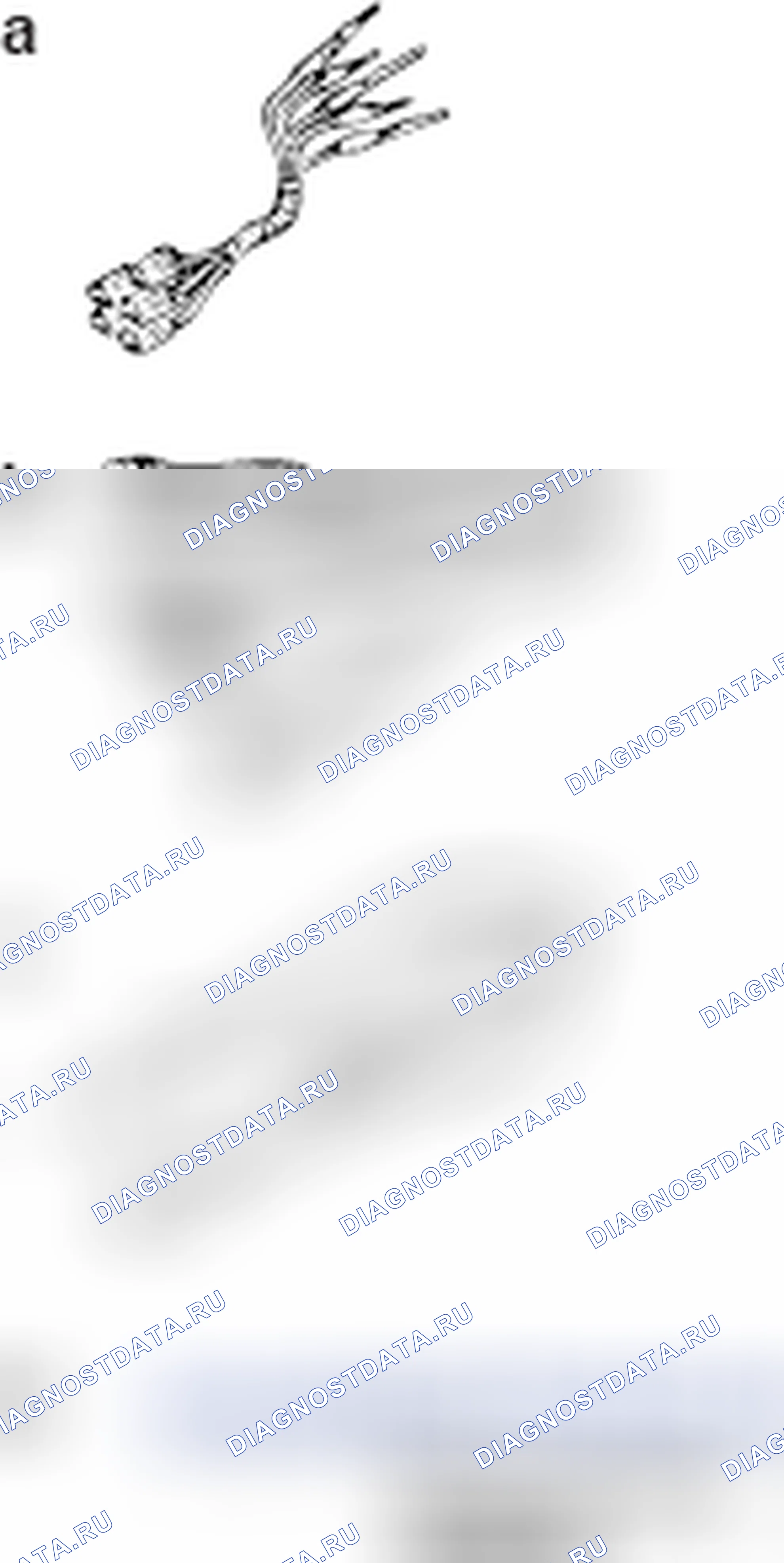 Рис. 374: СПЕЦИАЛЬНЫЕ ИНСТРУМЕНТЫ. Mitsubishi Lancer Ralliart X рестайлинг