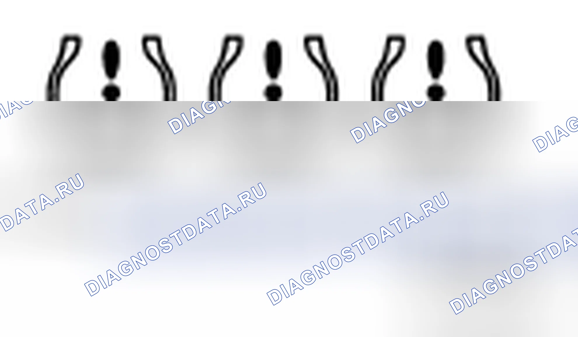 Рис. 13. BMW 4 серия F32/F33 рестайлинг