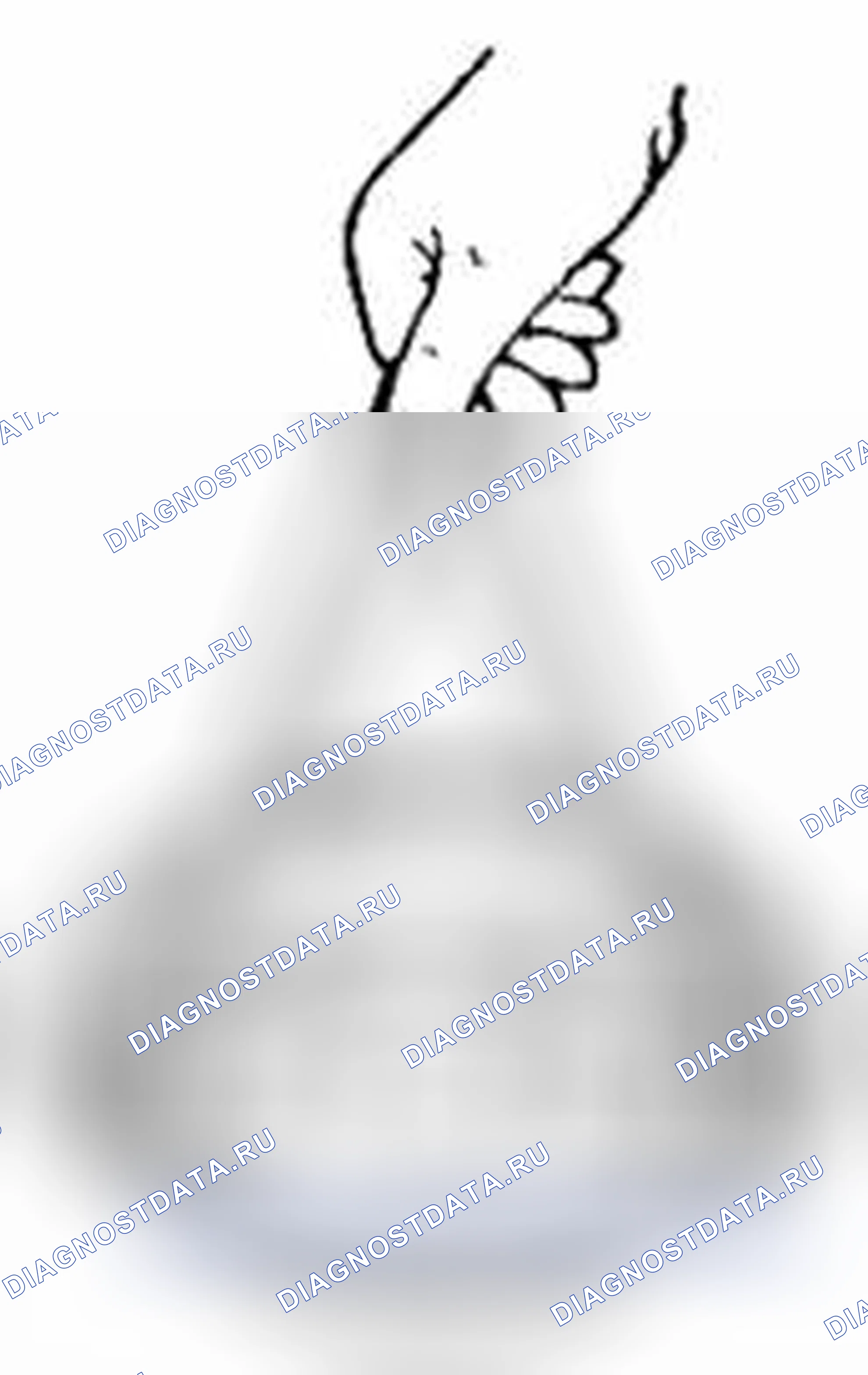 Рис. 111: Тормозной барабан. Suzuki SX4 I рестайлинг
