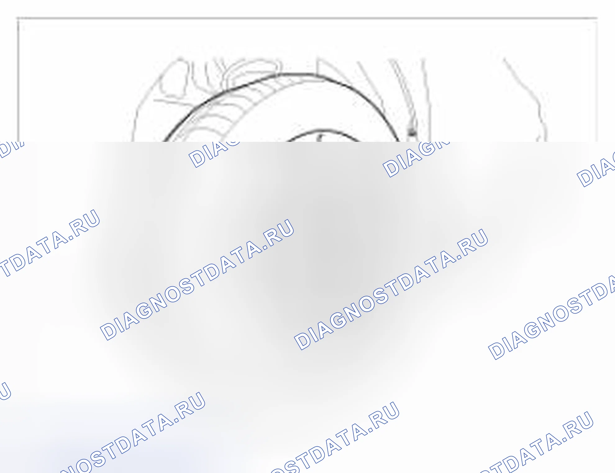 Рис. 21: Замена. BMW 6 серия F06/F13/F12
