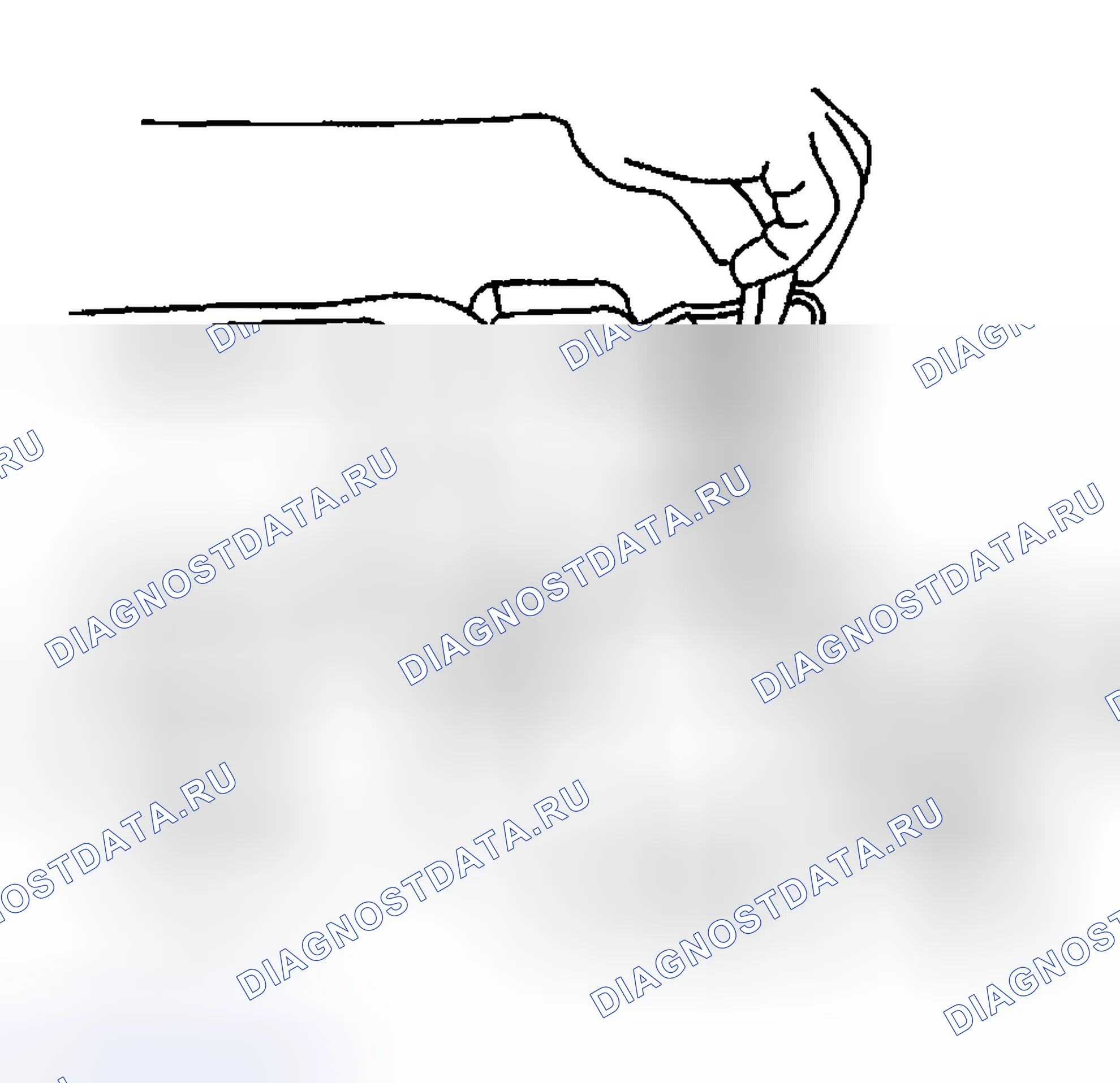 Рис. 185: Порядок демонтажа. Hyundai Venue I
