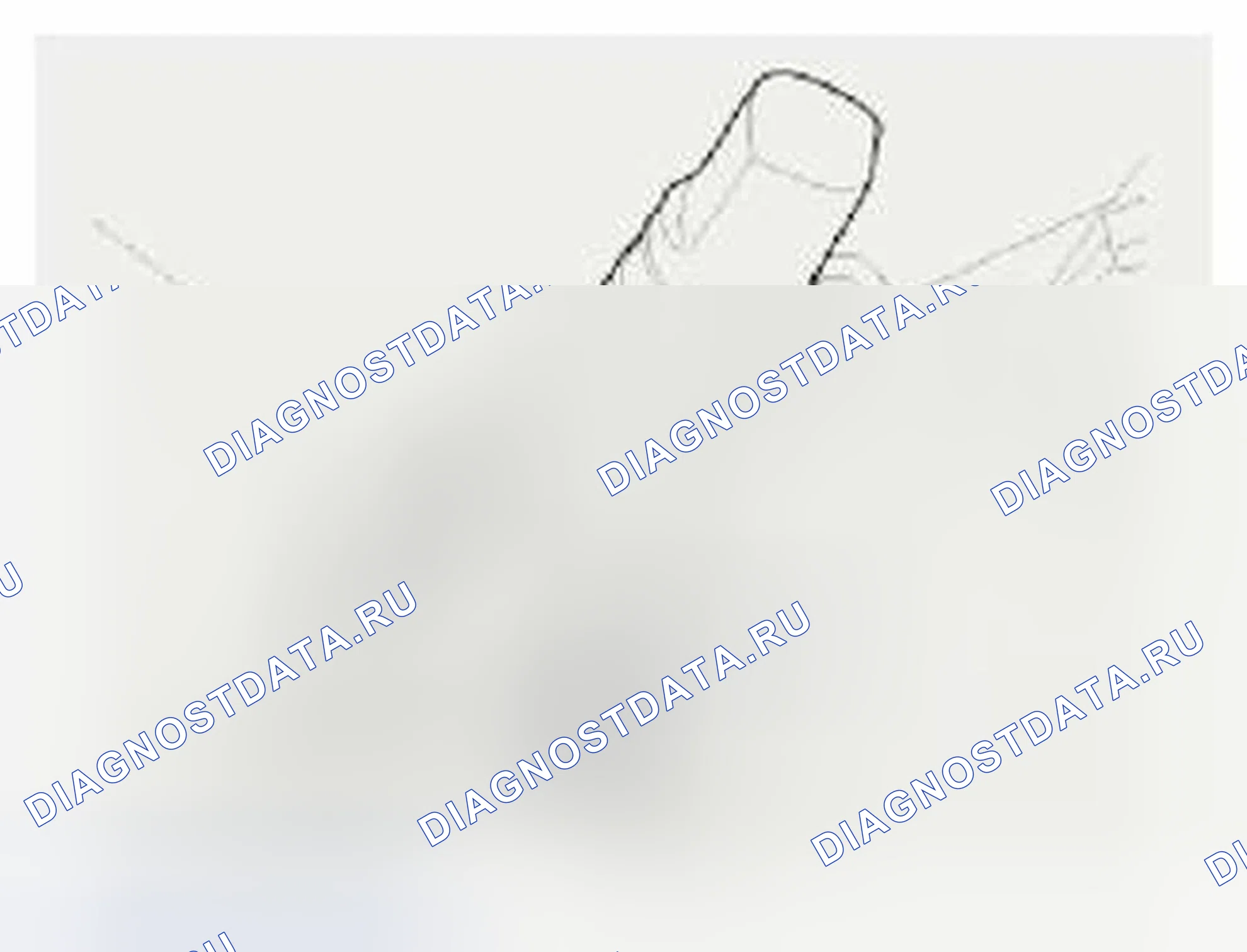 Рис. 6. Hyundai Veloster I