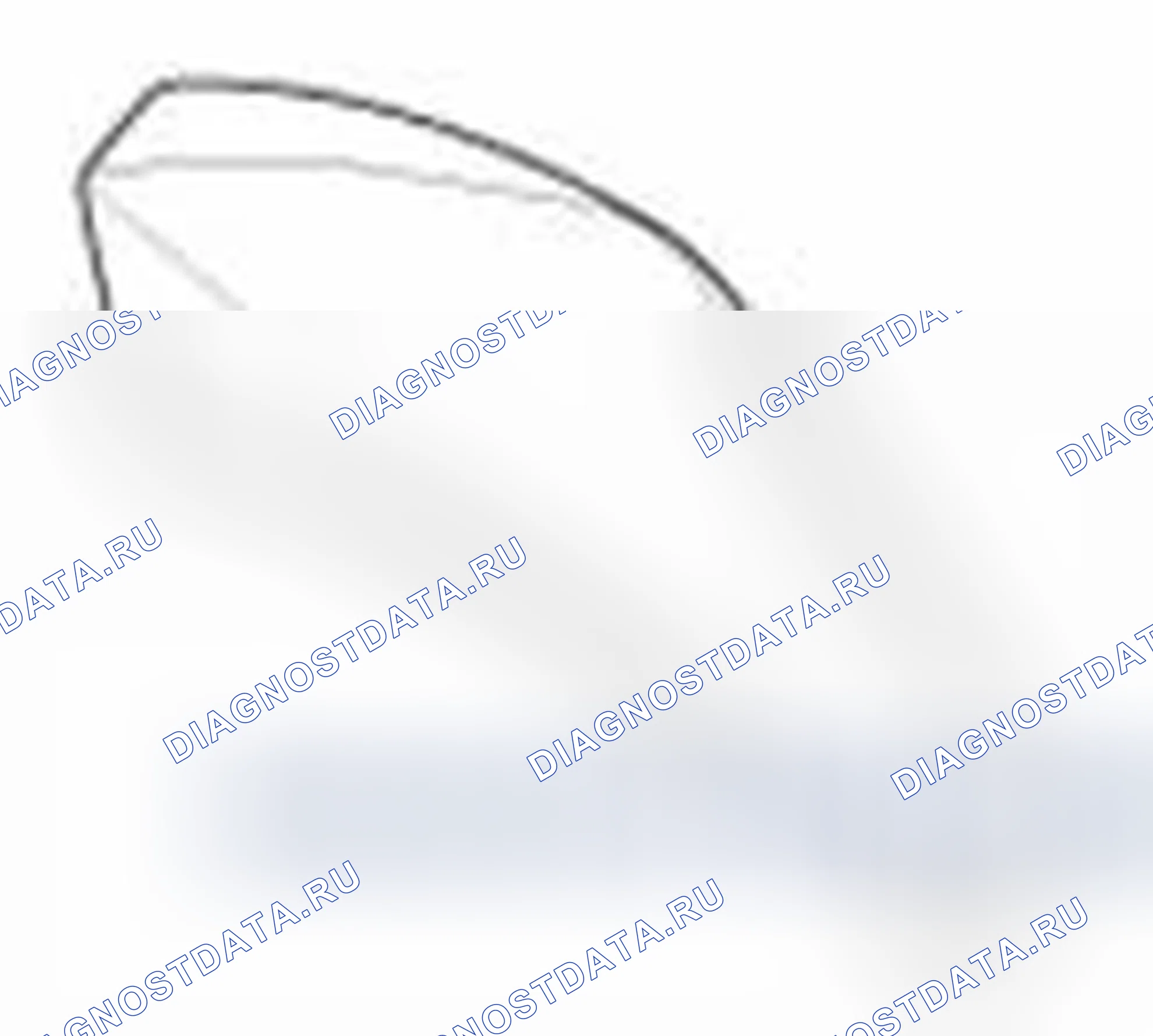 Рис. 43. Hyundai Sonata VI