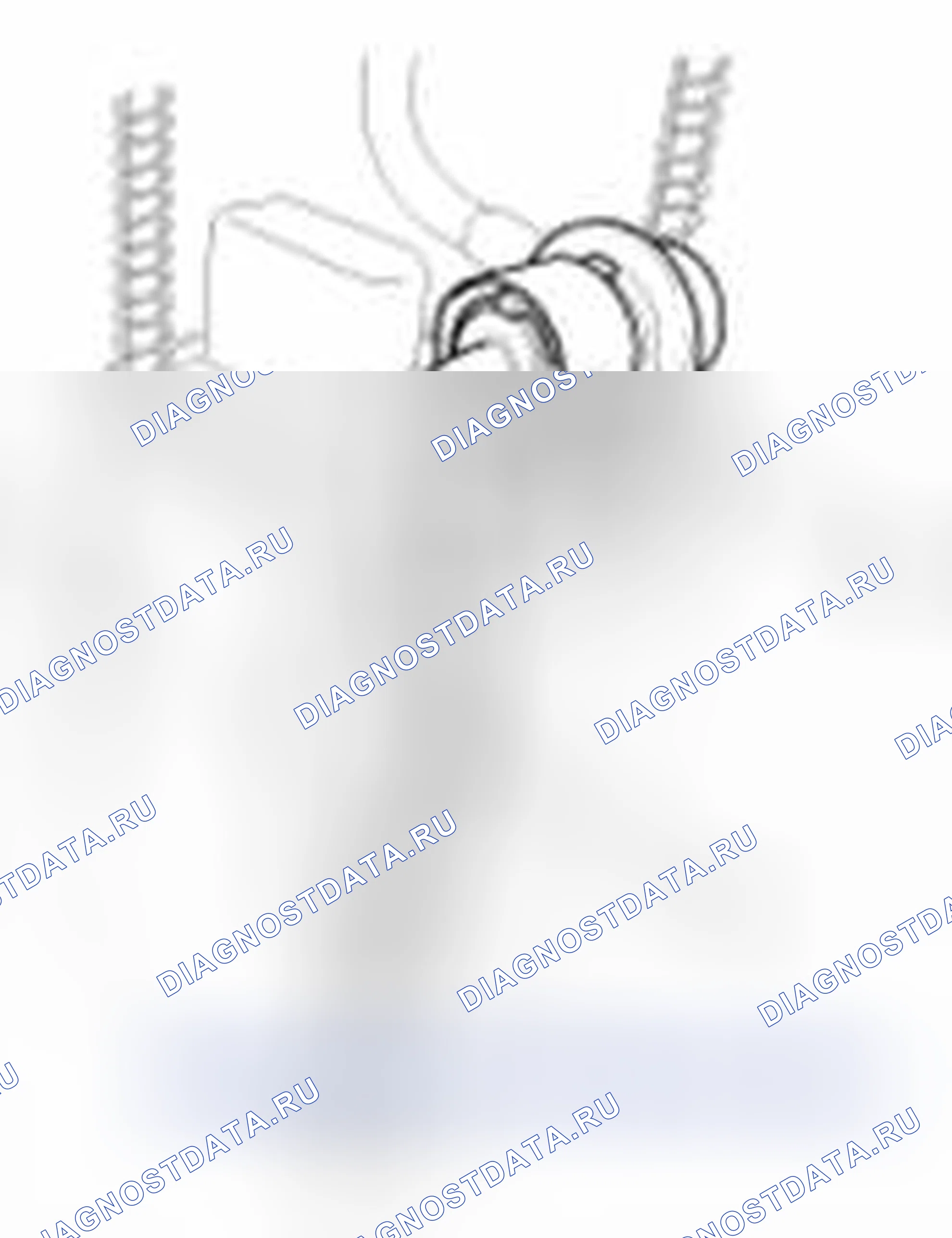 Рис. 30. Kia Forte I
