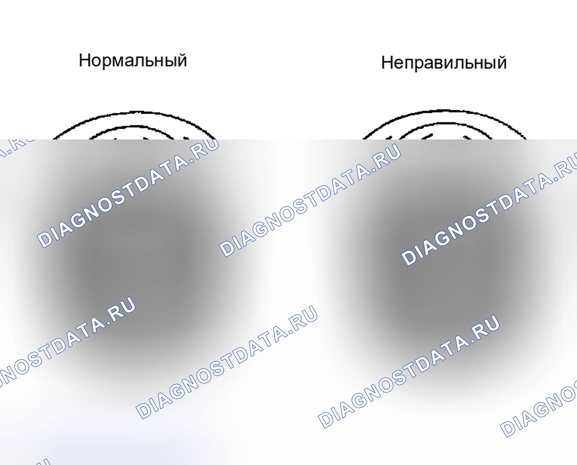 Рис. 2: КРОВОТЕЧЕНИЕ. Honda Accord II