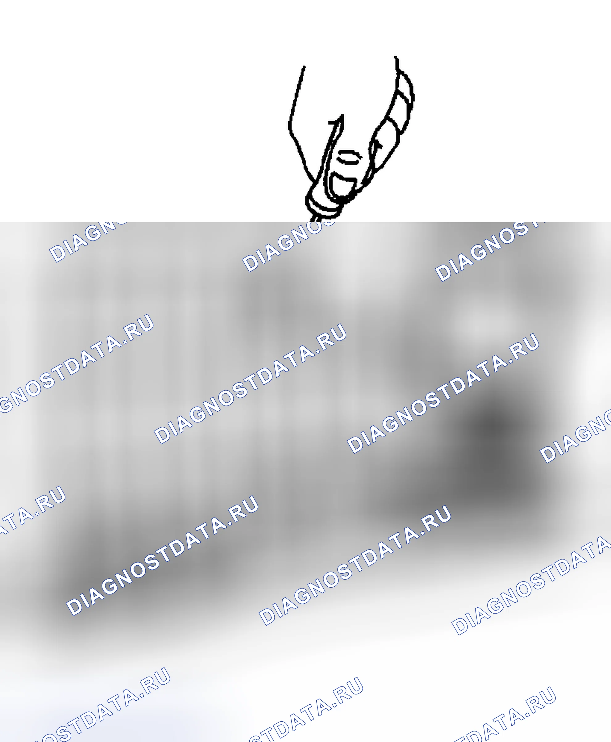 Рис. 270: Процедура установки. Hyundai Venue I