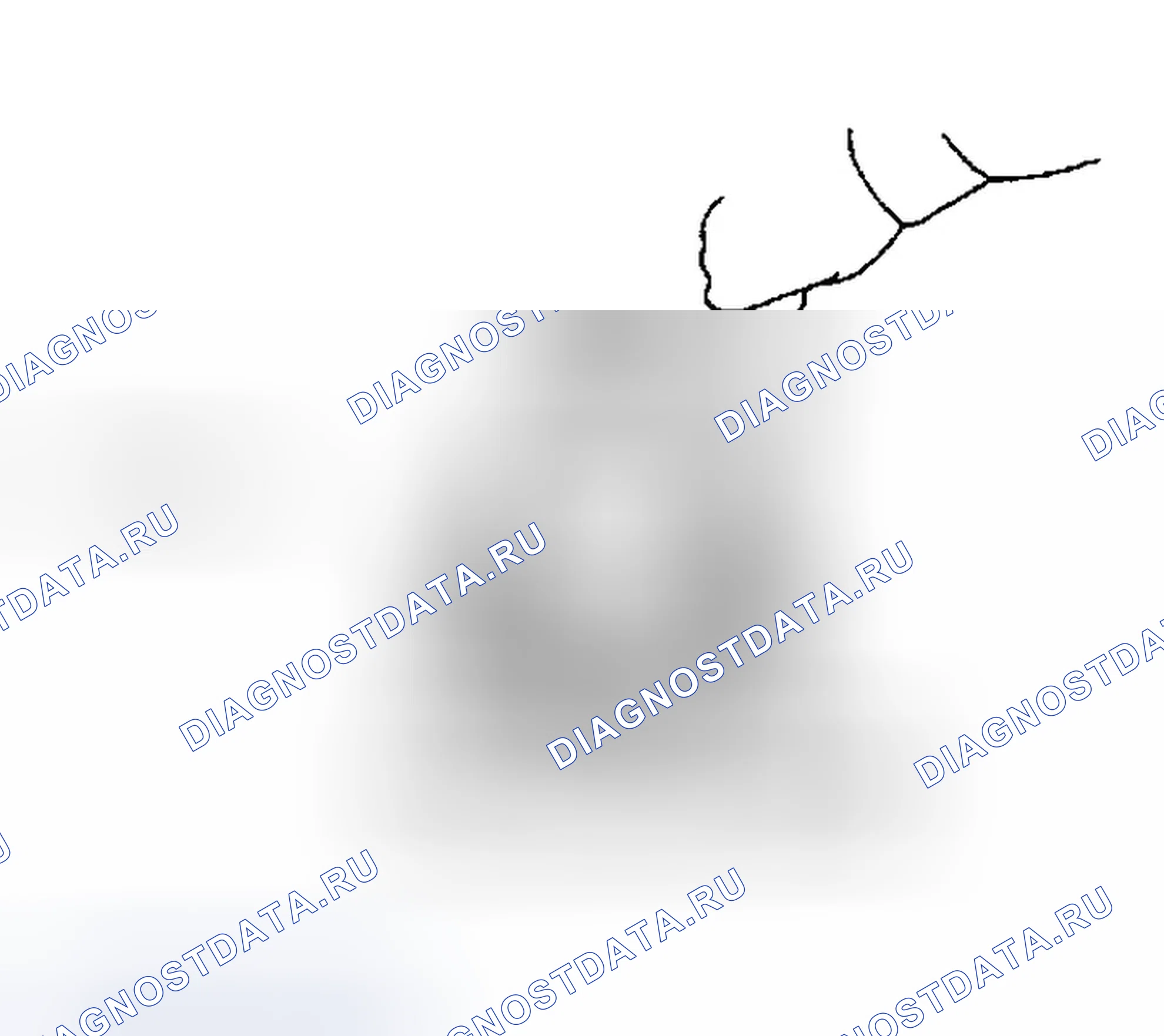 Рис. 82: СБОРКА КОРПУСА ДИФФЕРЕНЦИАЛА В СБОРЕ (R200V). Infiniti G35 III