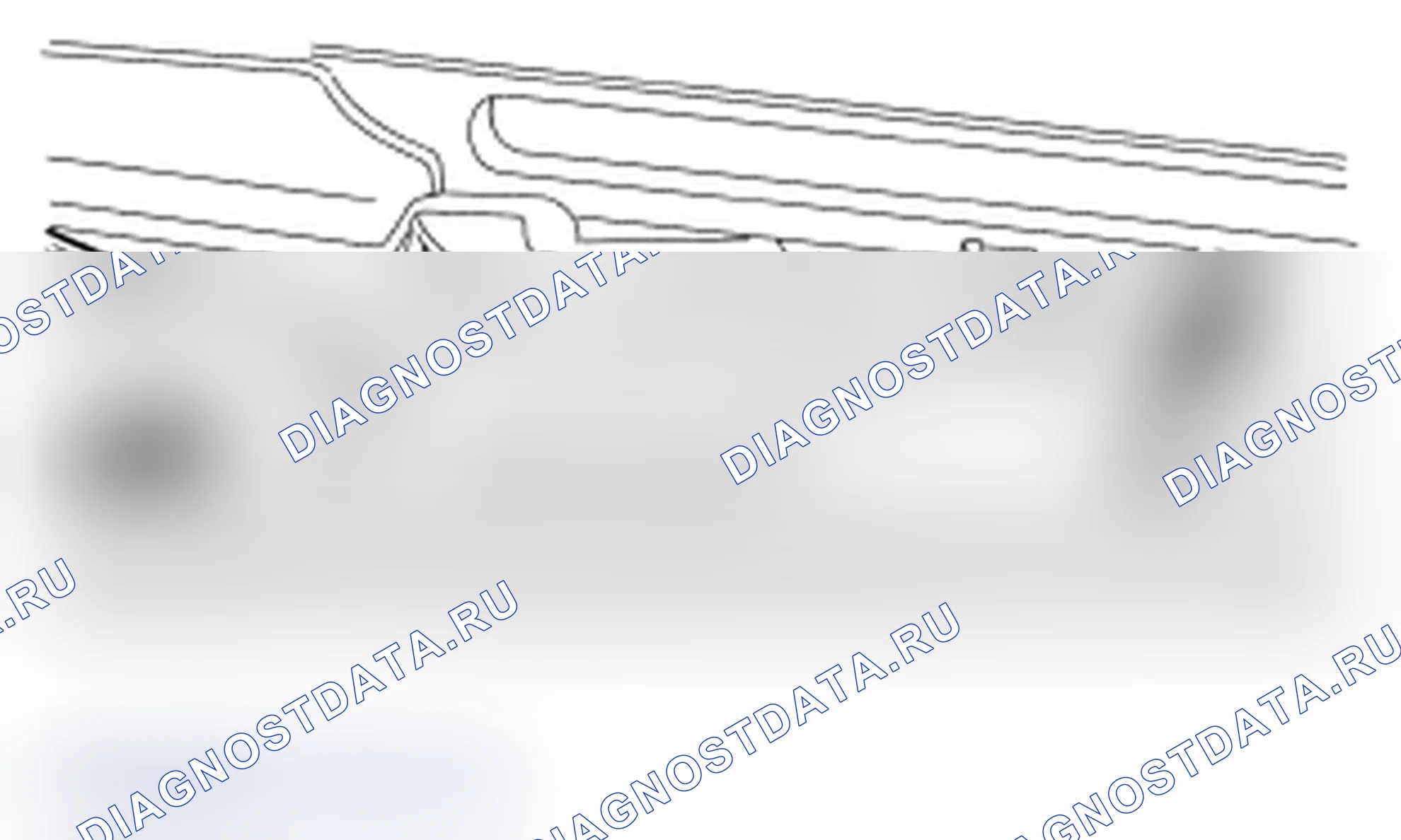 Рис. 11: Регулировка синхронизации. Lincoln Zephyr US