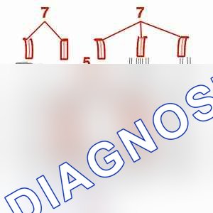 Повторная установка: двигателя (блок цилиндров) — b1ck078c. Peugeot Expert I