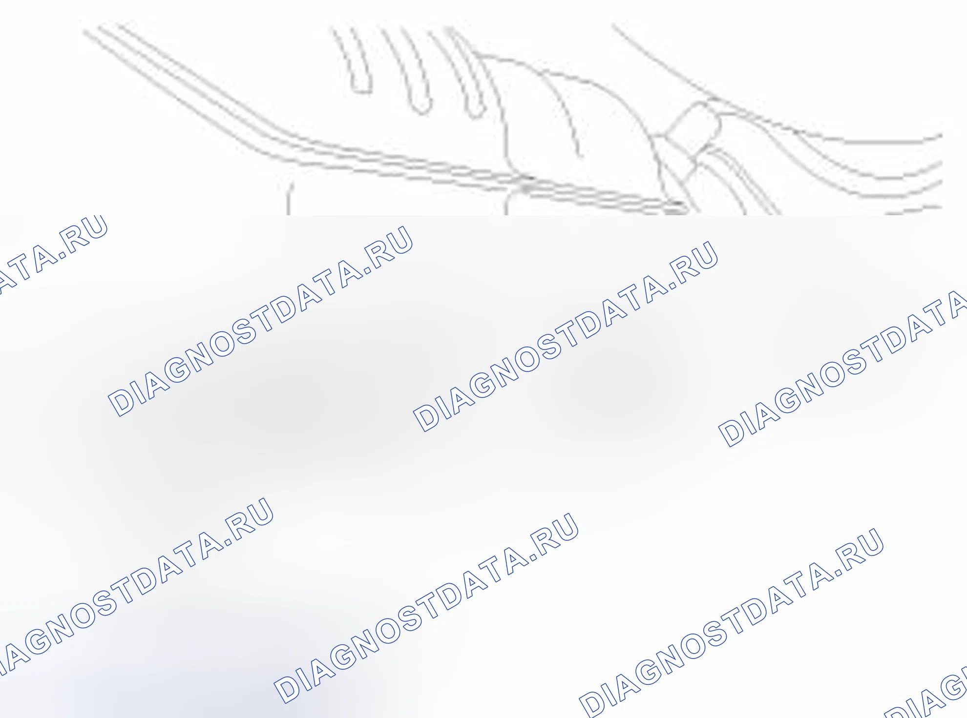 Рис. 15. Kia Forte I