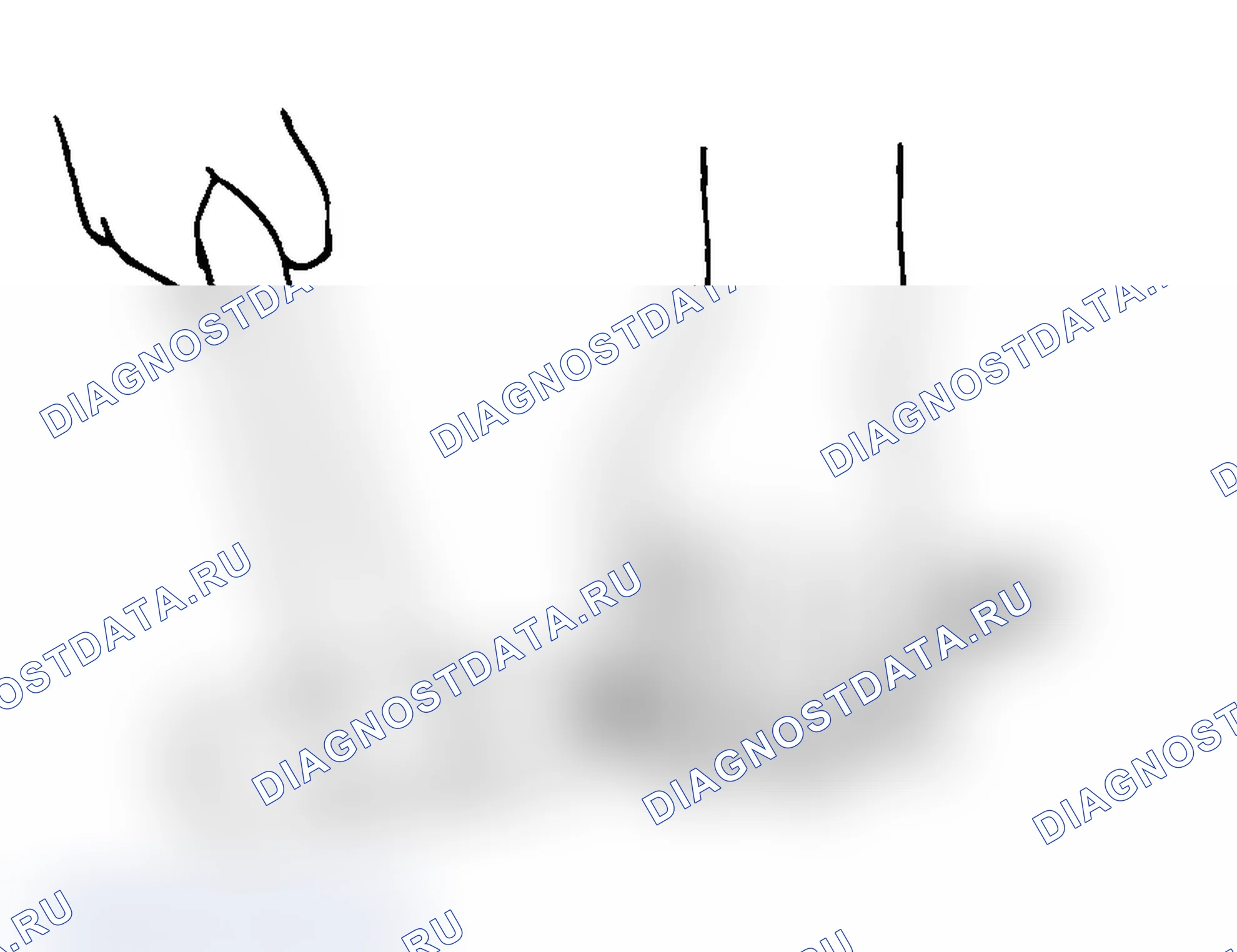 Рис. 57: <<B>> ДЕМОНТАЖ НИЖНЕГО МАСЛЯНОГО УПЛОТНЕНИЯ/ШЕСТЕРНИ И КЛАПАНА В СБОРЕ. Mitsubishi Lancer Evolution IX