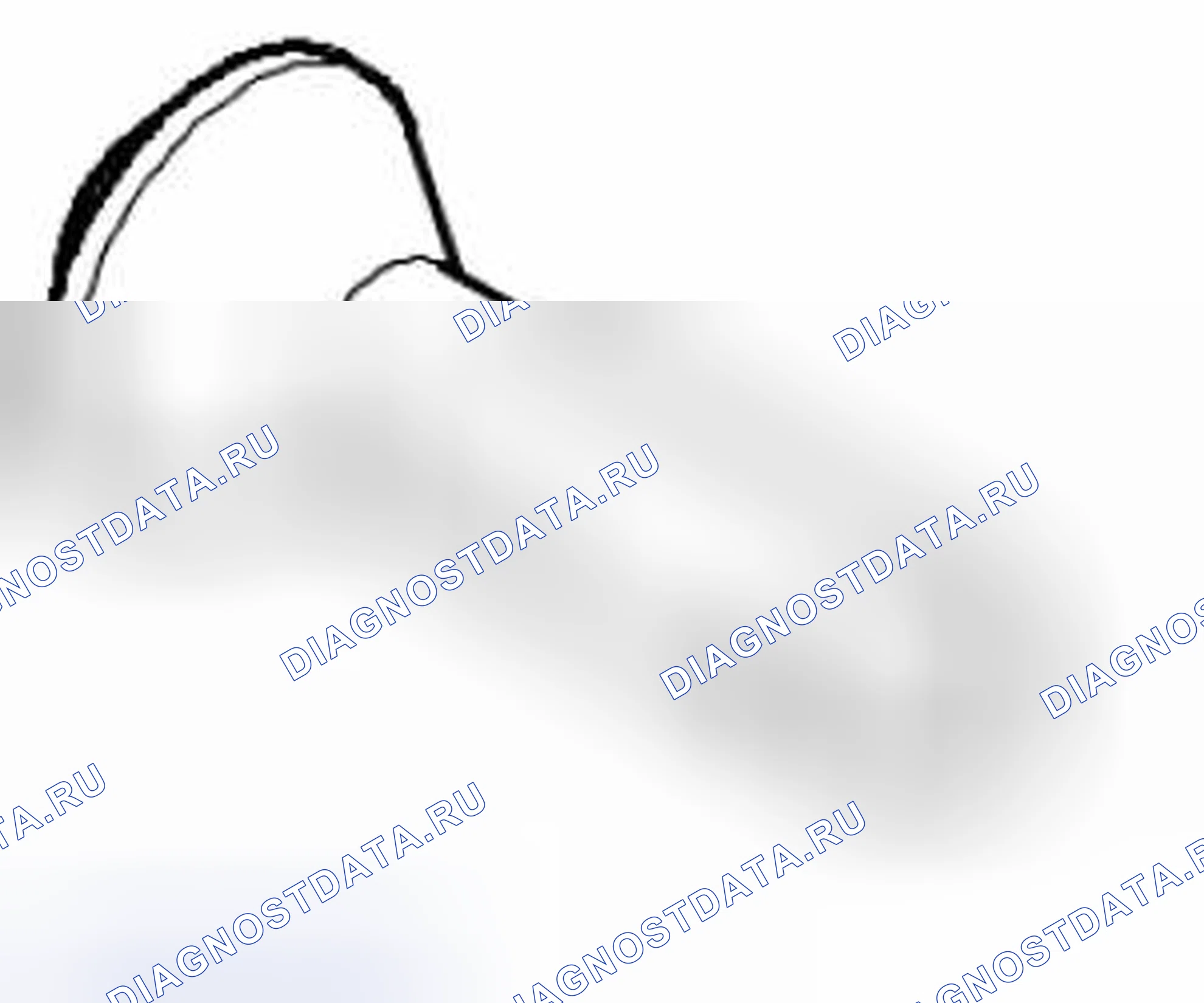 Рис. 223: DT-49068 Дрейф фитинга. Saab 9-3 II