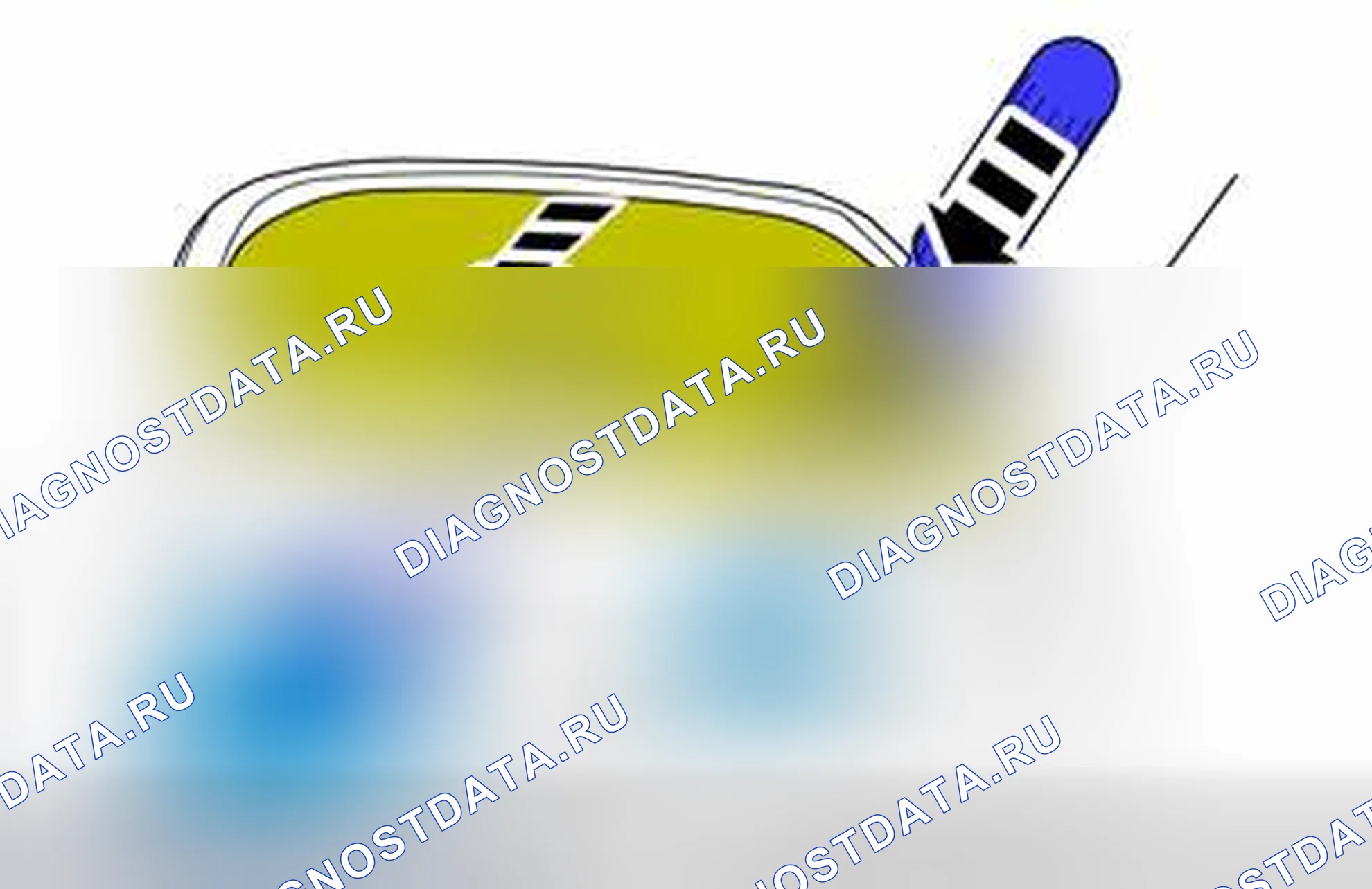 Рис. 18: ДЕМОНТАЖ И МОНТАЖ. Volvo V50 I рестайлинг
