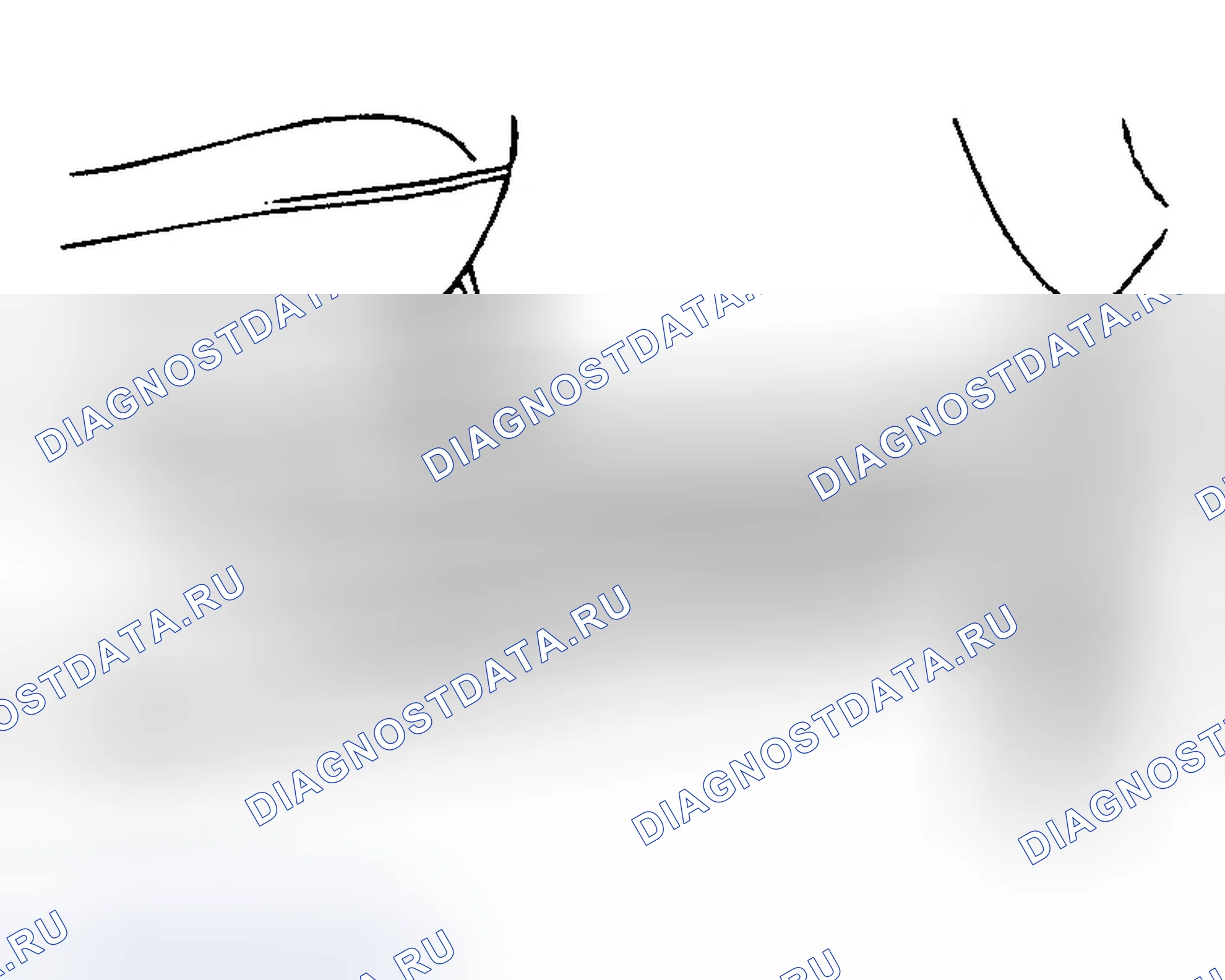 Рис. 34. Hyundai Elantra III