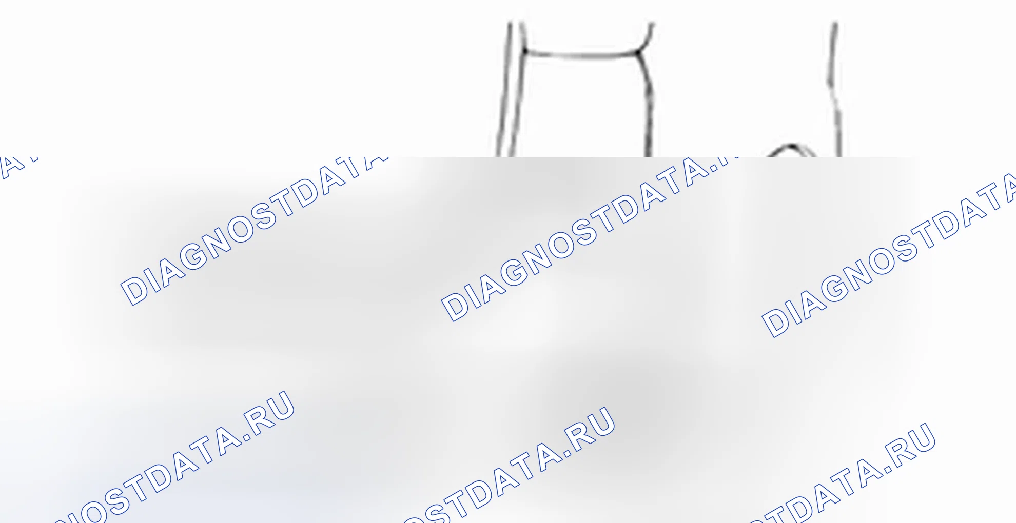 Снятие заднего бампера. Hyundai H-1 A1